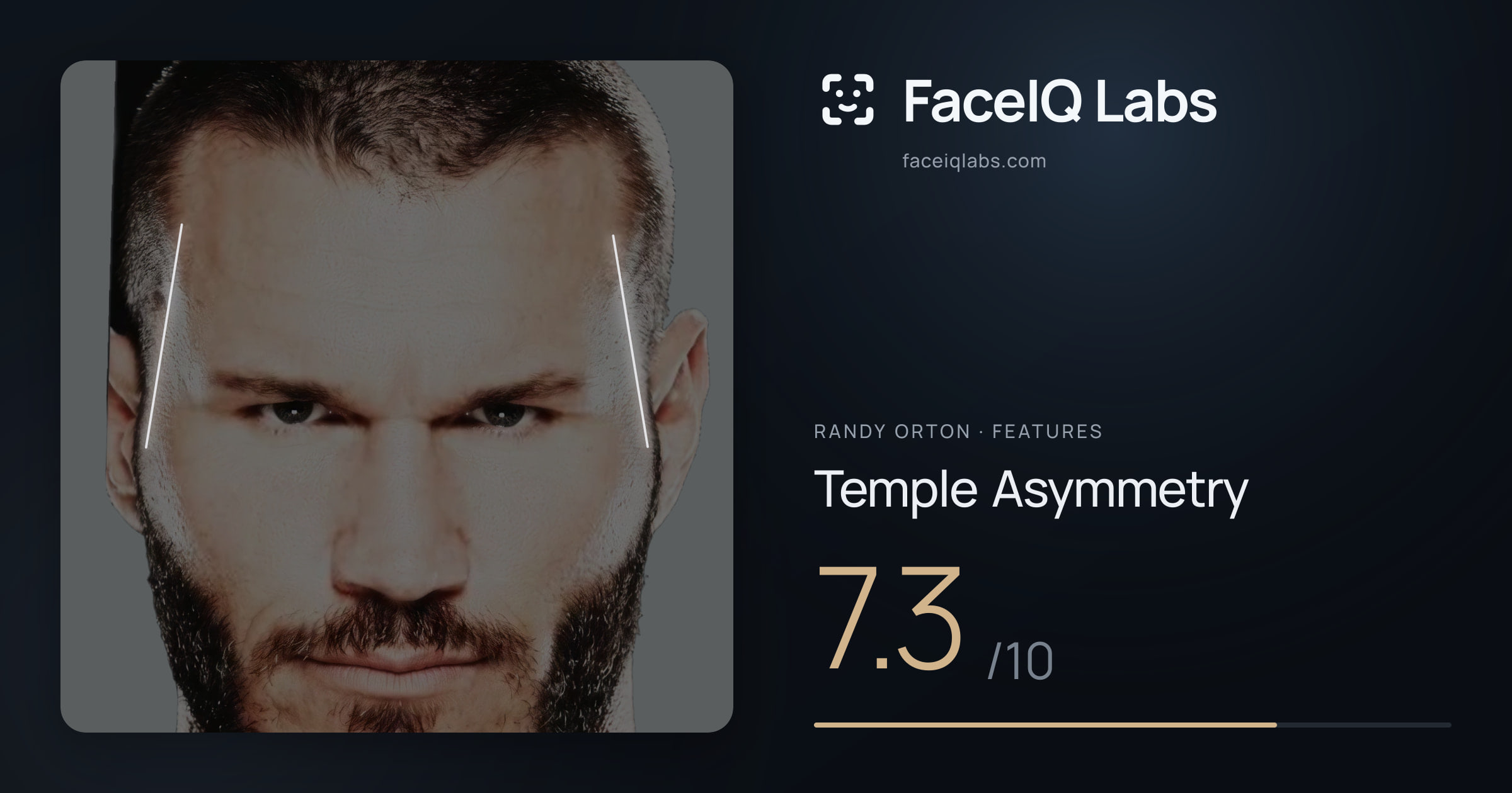 Randy Orton Temple Asymmetry: 7.3/10, drawn on the photo