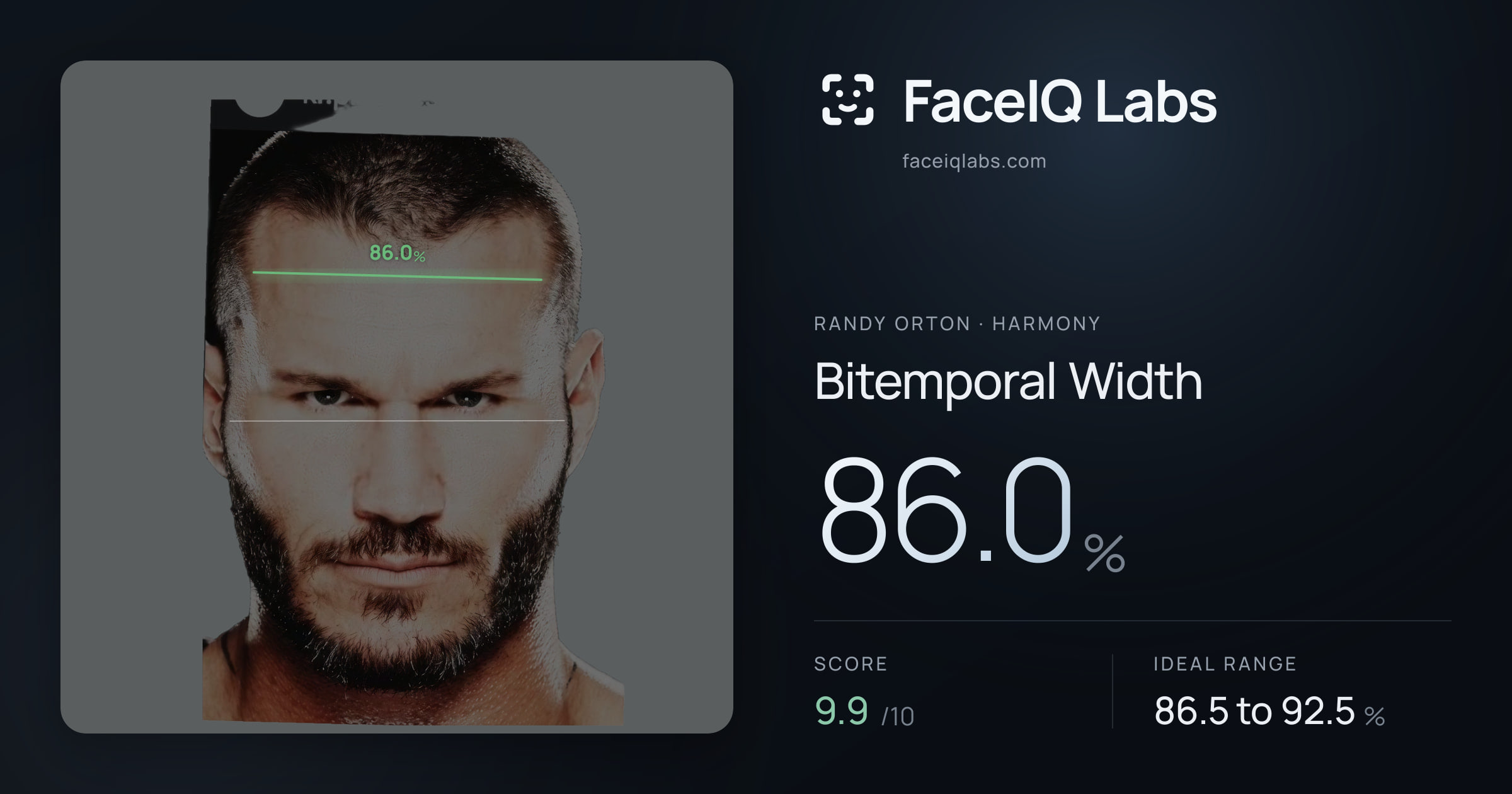 Randy Orton Bitemporal Width: 86.0%, drawn on the photo