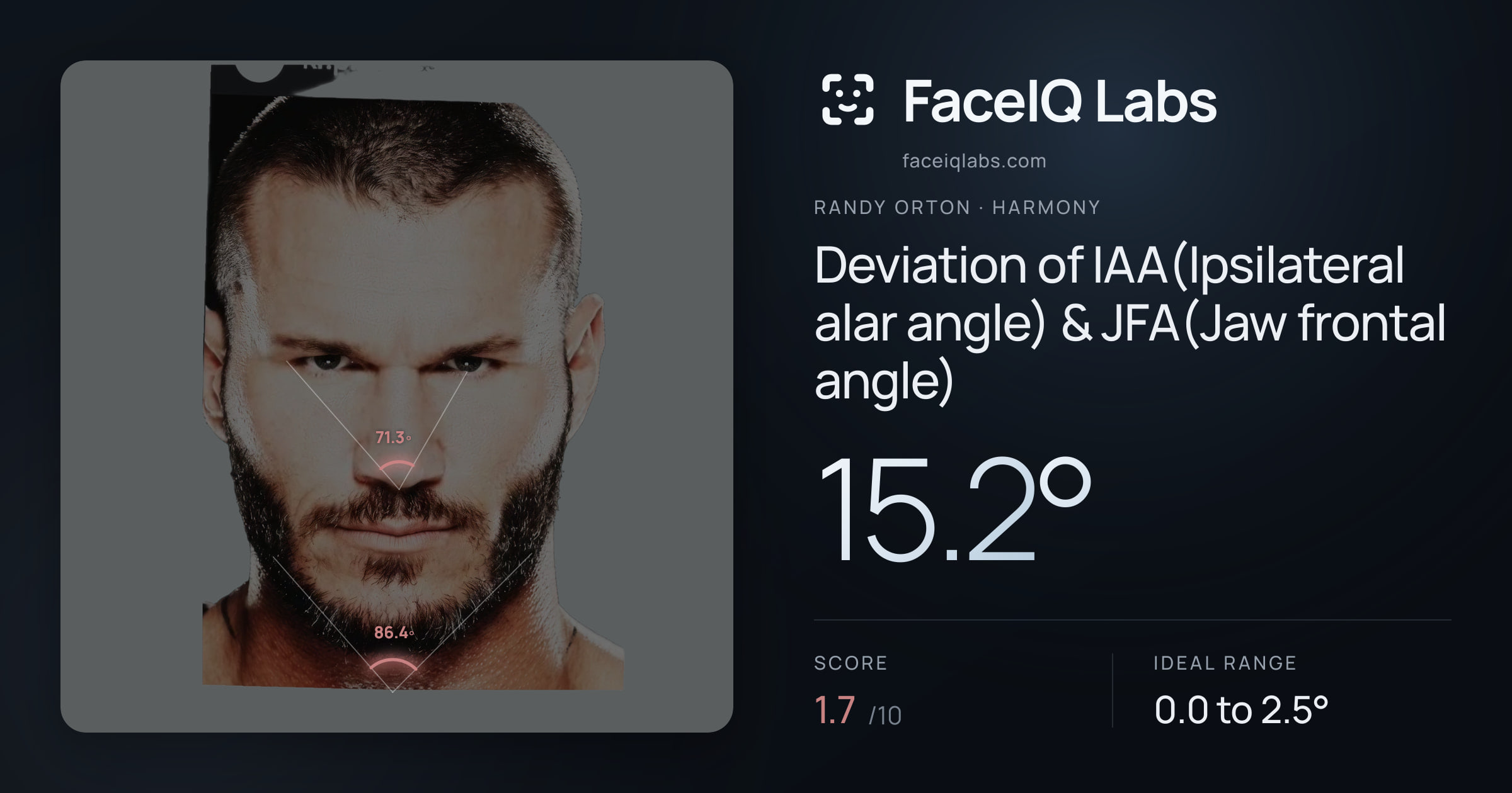 Randy Orton Deviation of IAA(Ipsilateral alar angle) & JFA(Jaw frontal angle): 15.2°, drawn on the photo