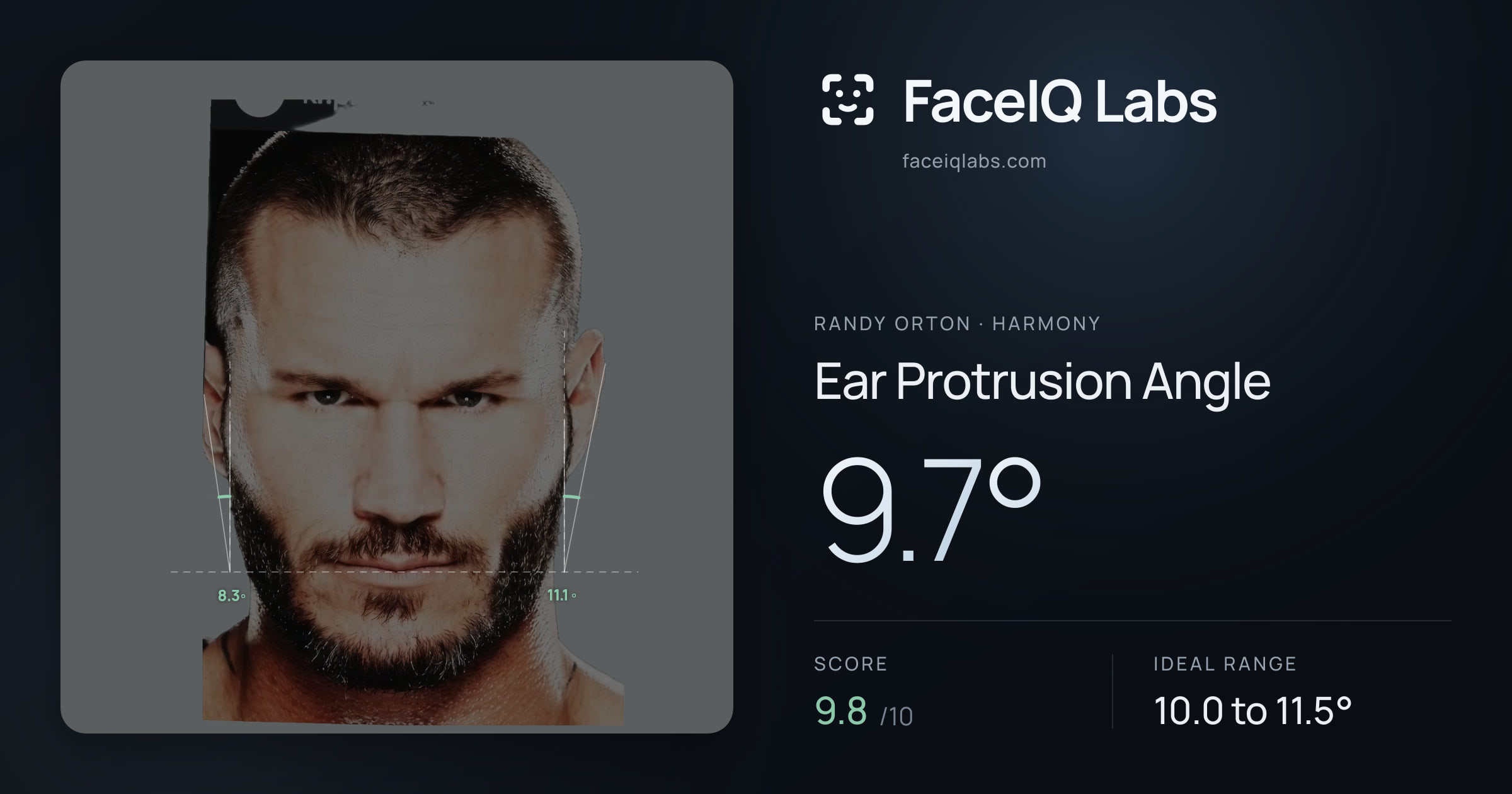 Randy Orton Ear Protrusion Angle: 9.7°, drawn on the photo