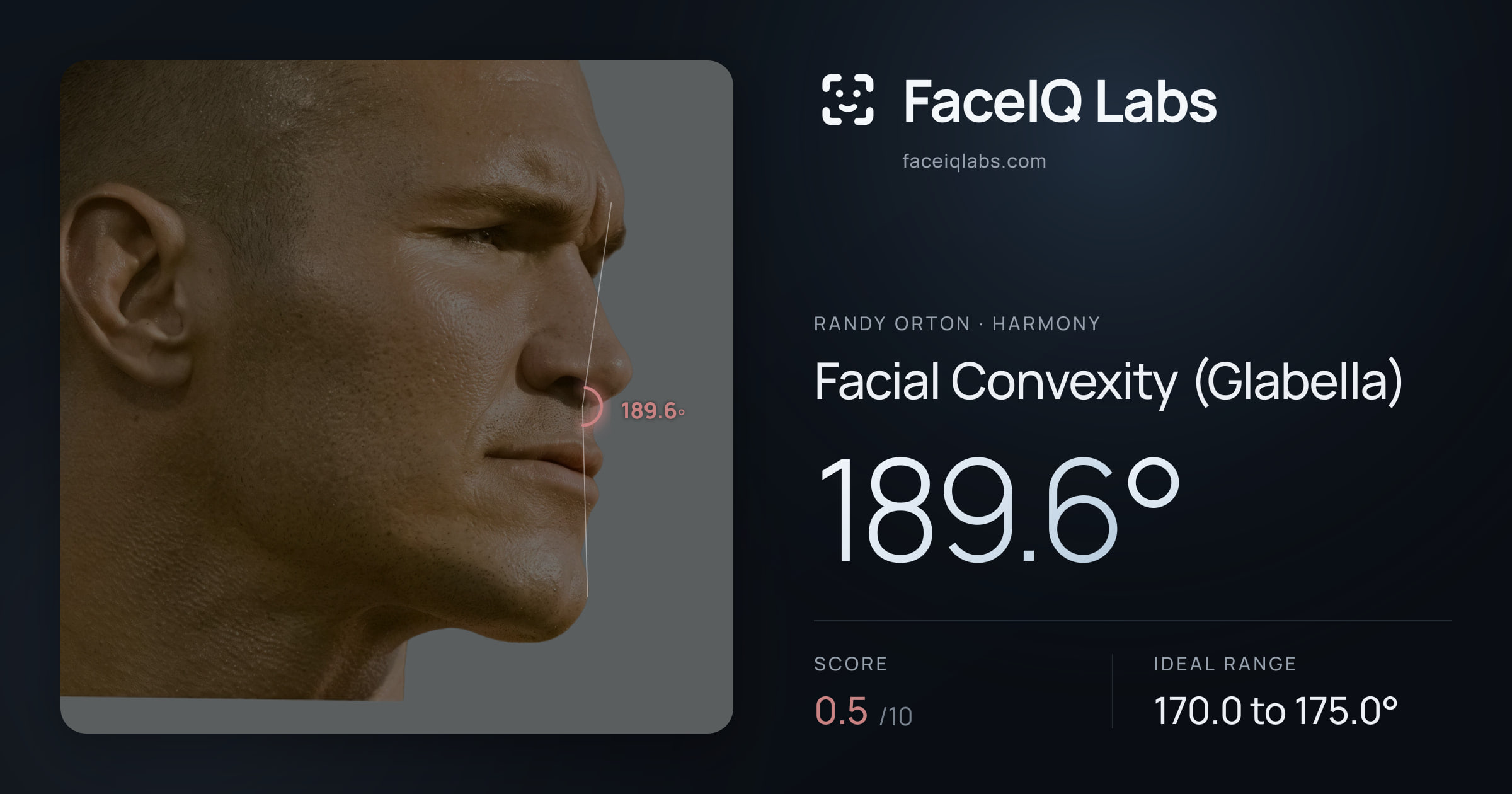 Randy Orton Facial Convexity (Glabella): 189.6°, drawn on the photo