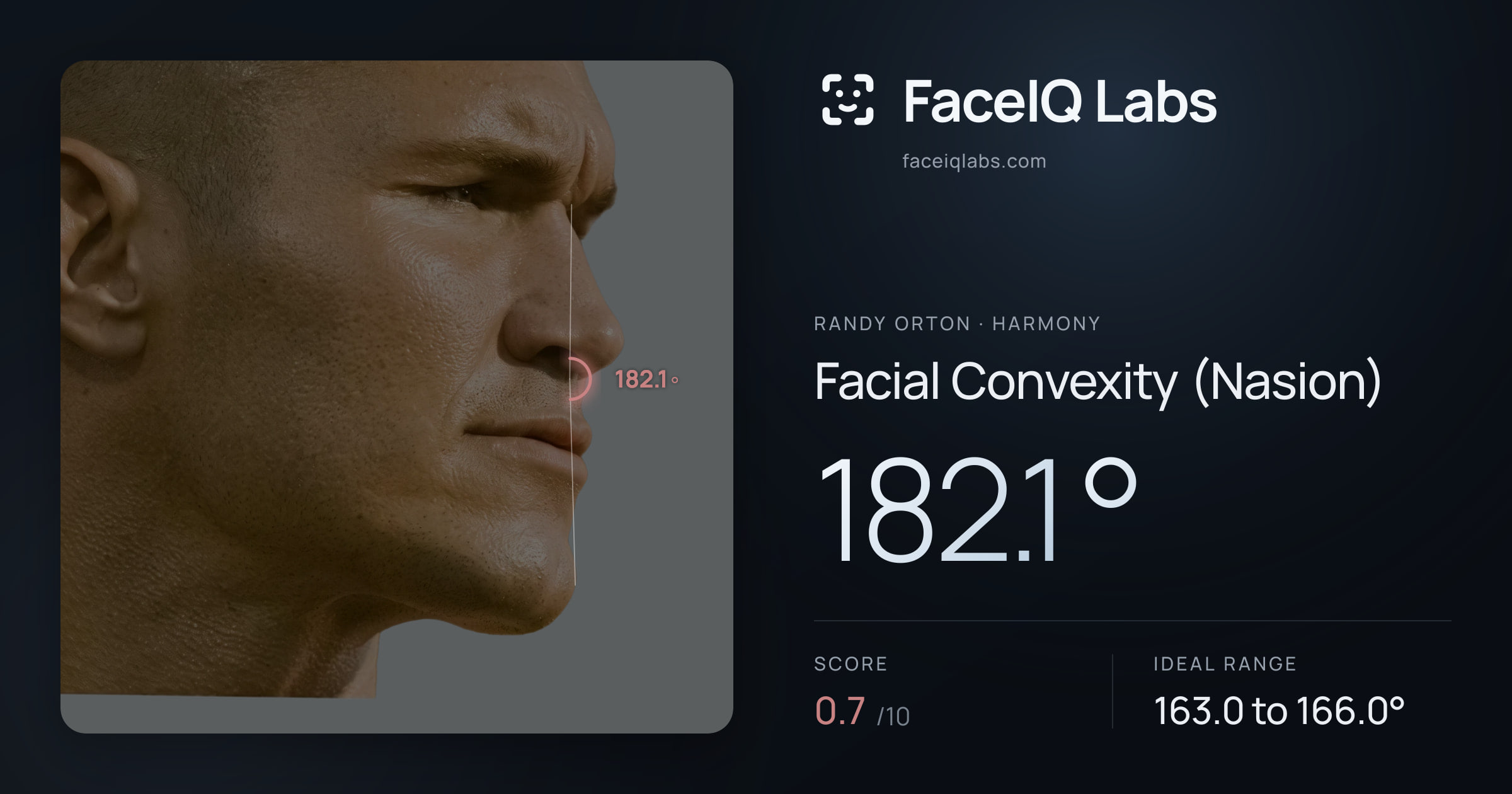 Randy Orton Facial Convexity (Nasion): 182.1°, drawn on the photo