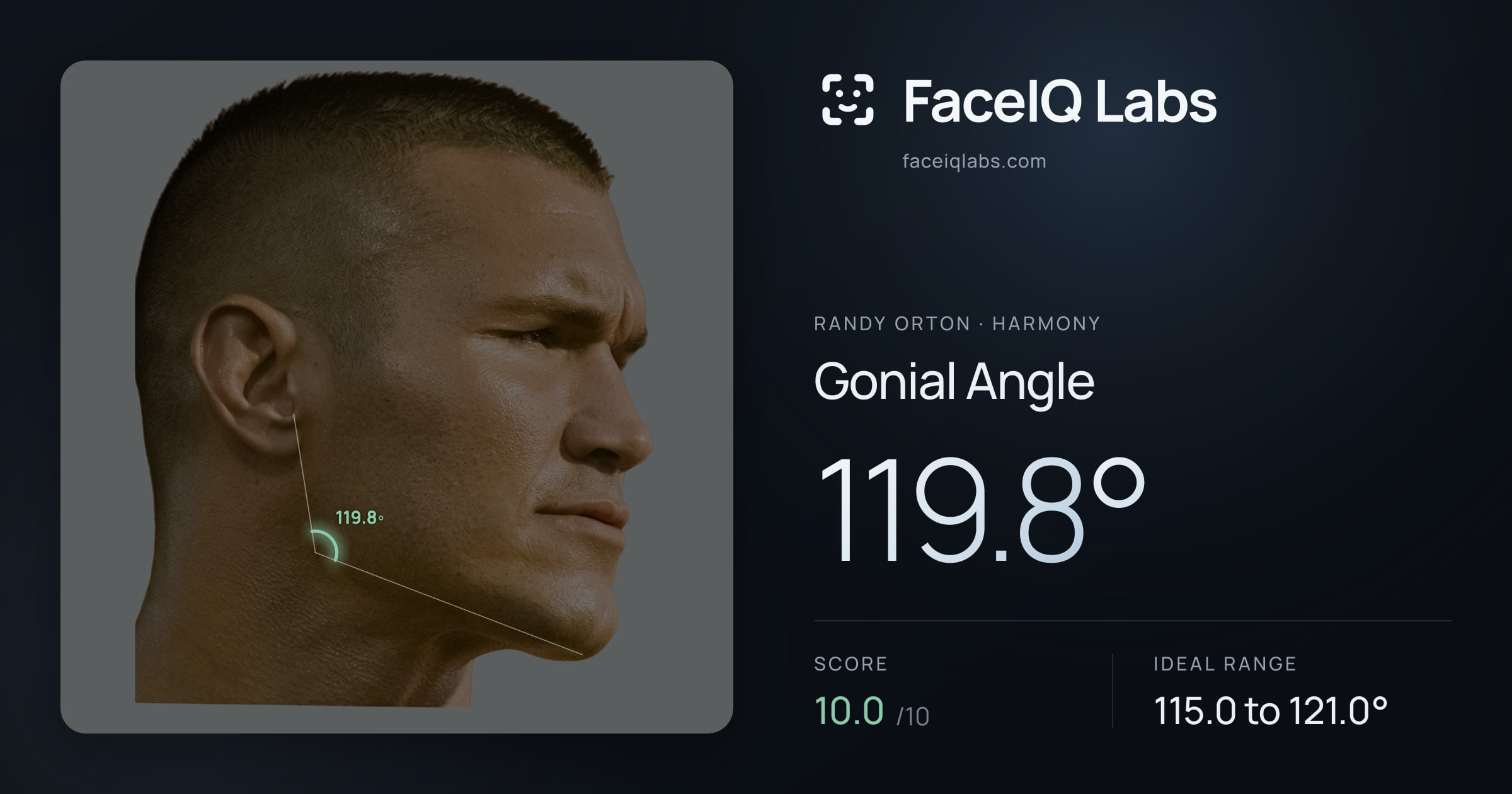 Randy Orton Gonial Angle: 119.8°, drawn on the photo
