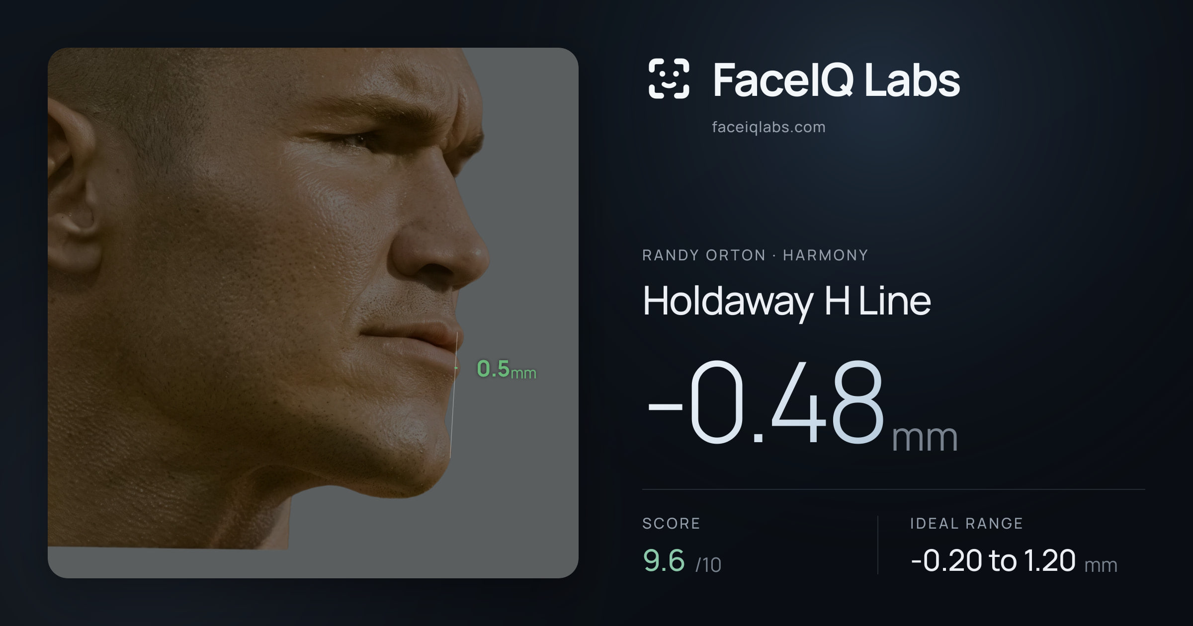 Randy Orton Holdaway H Line: -0.48mm, drawn on the photo