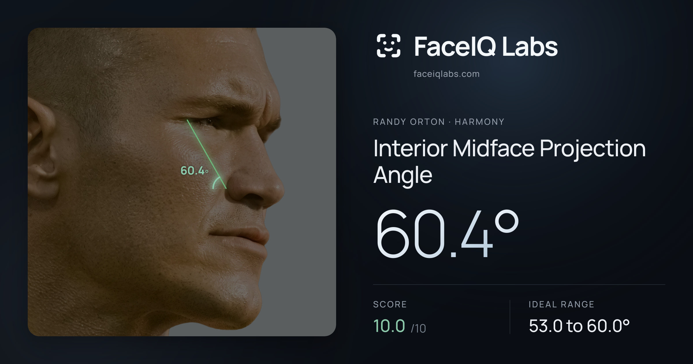 Randy Orton Interior Midface Projection Angle: 60.4°, drawn on the photo