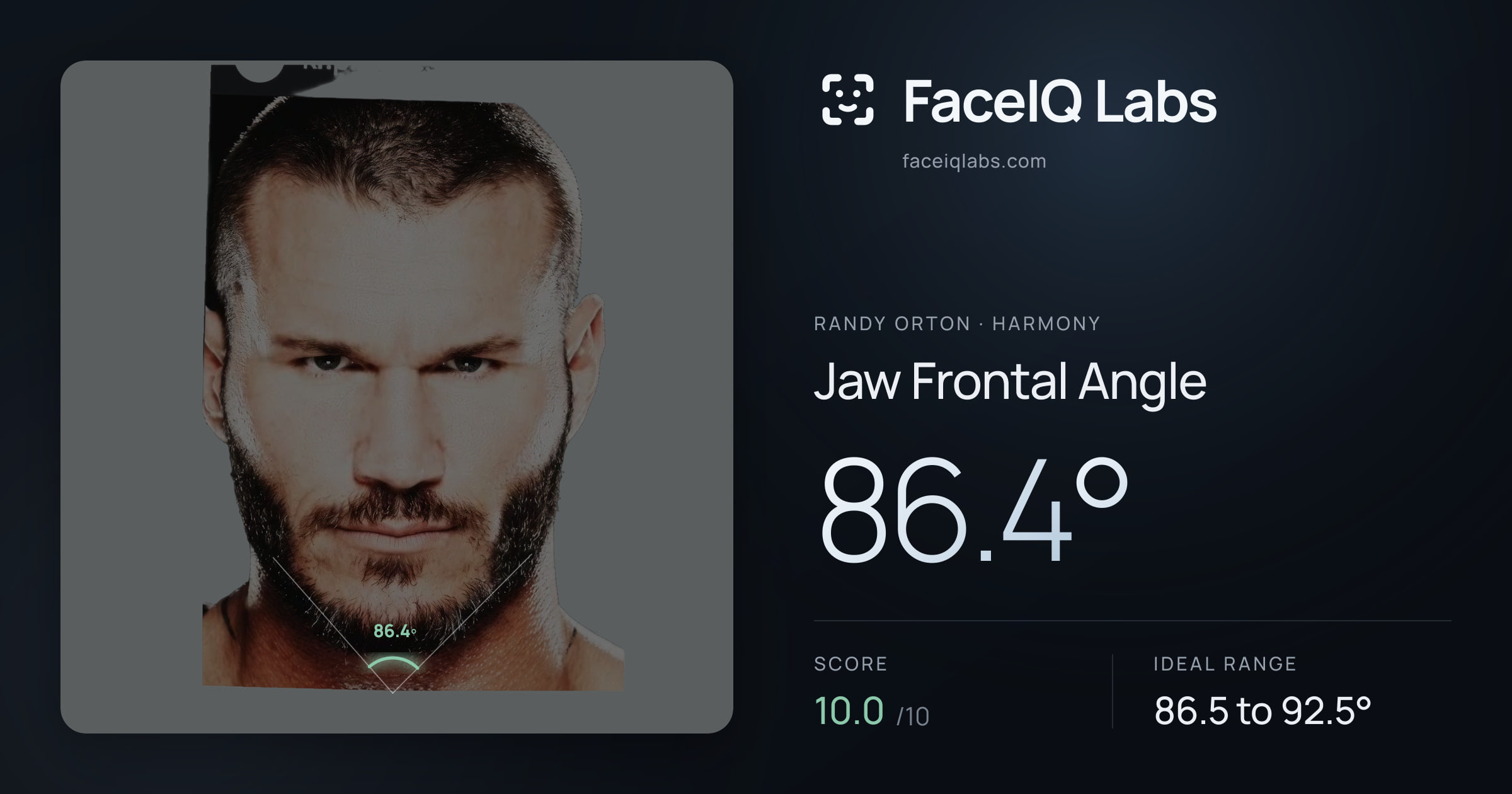 Randy Orton Jaw Frontal Angle: 86.4°, drawn on the photo