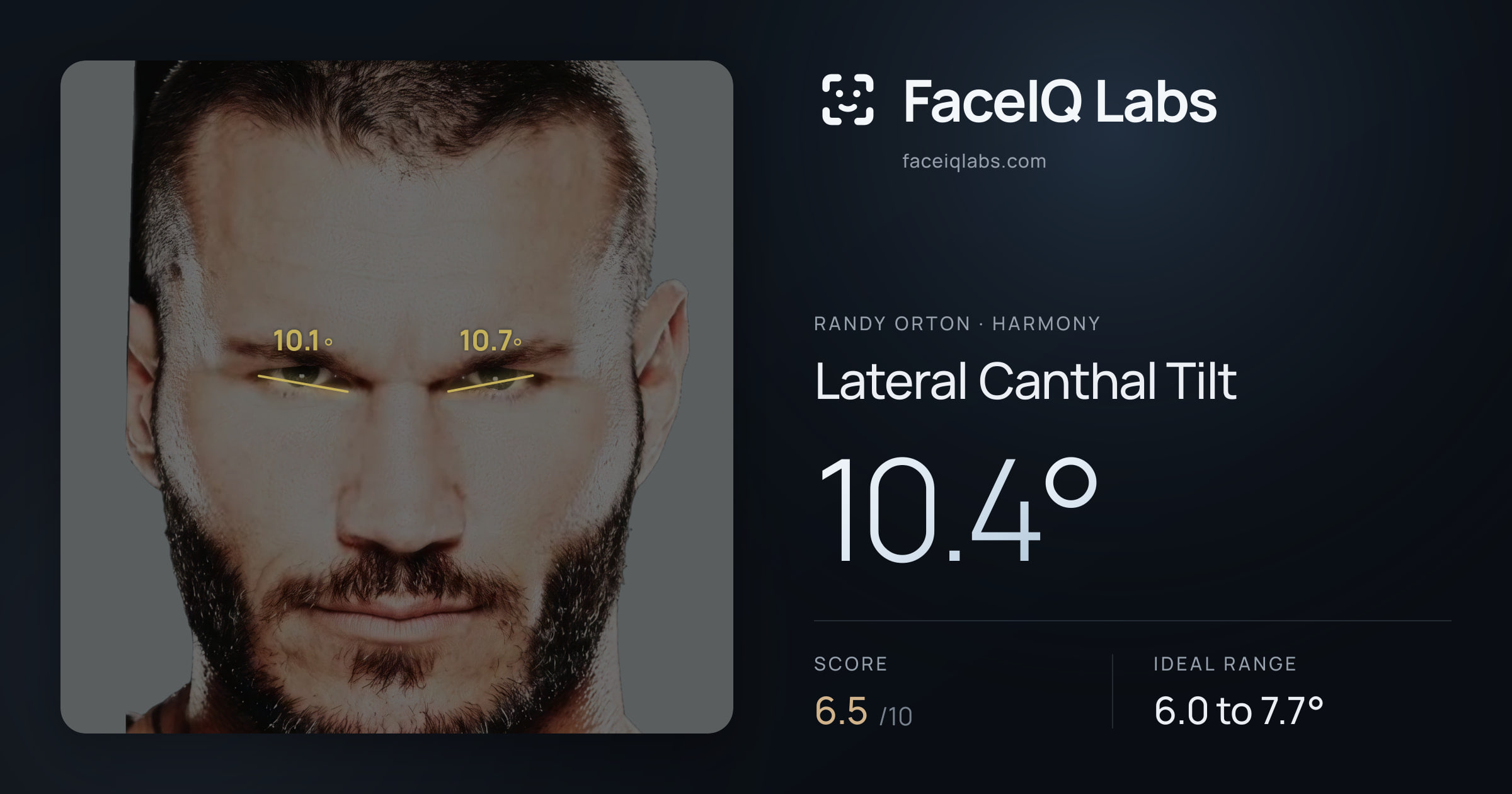 Randy Orton Lateral Canthal Tilt: 10.4°, drawn on the photo