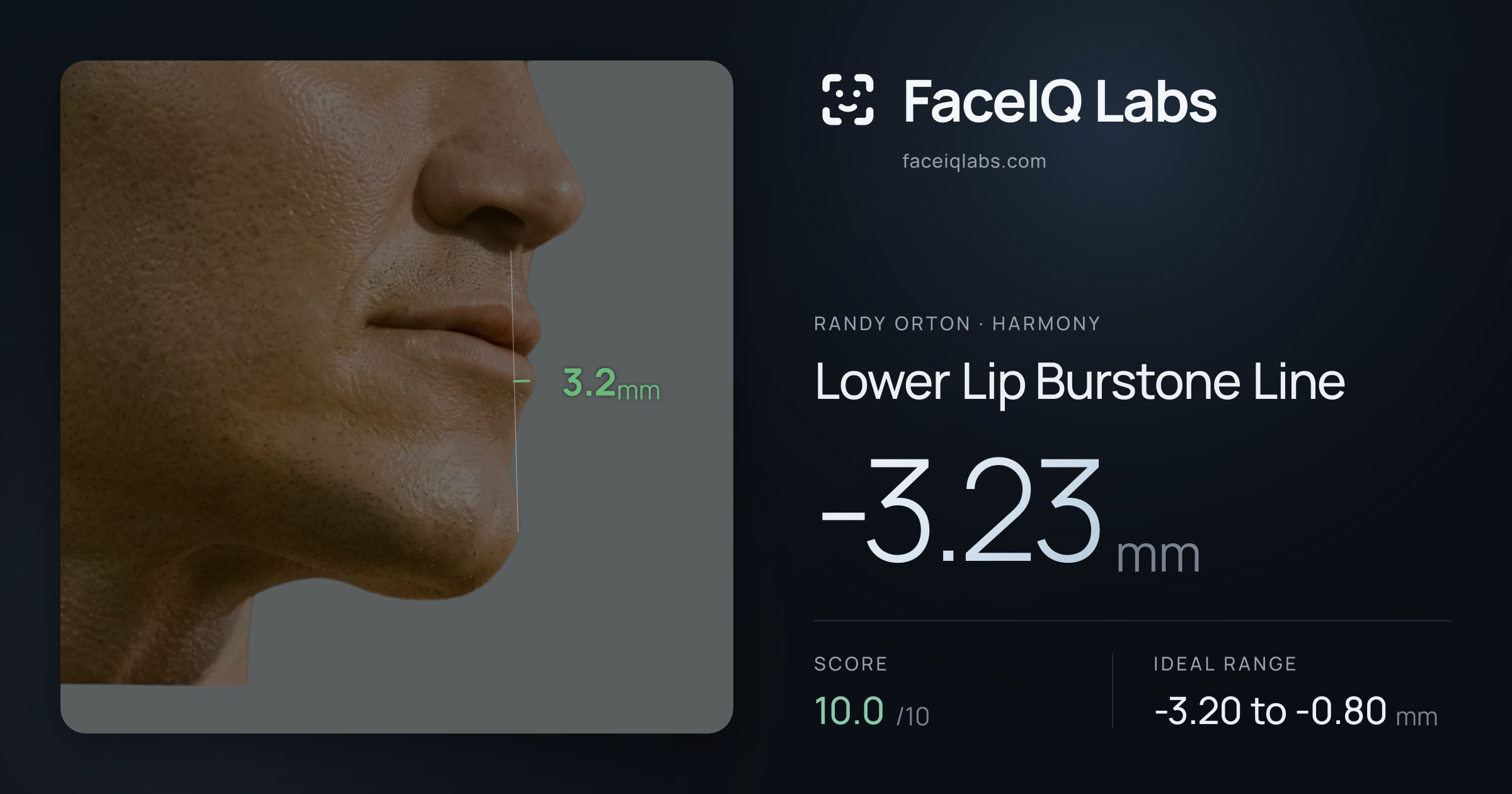 Randy Orton Lower Lip Burstone Line: -3.23mm, drawn on the photo
