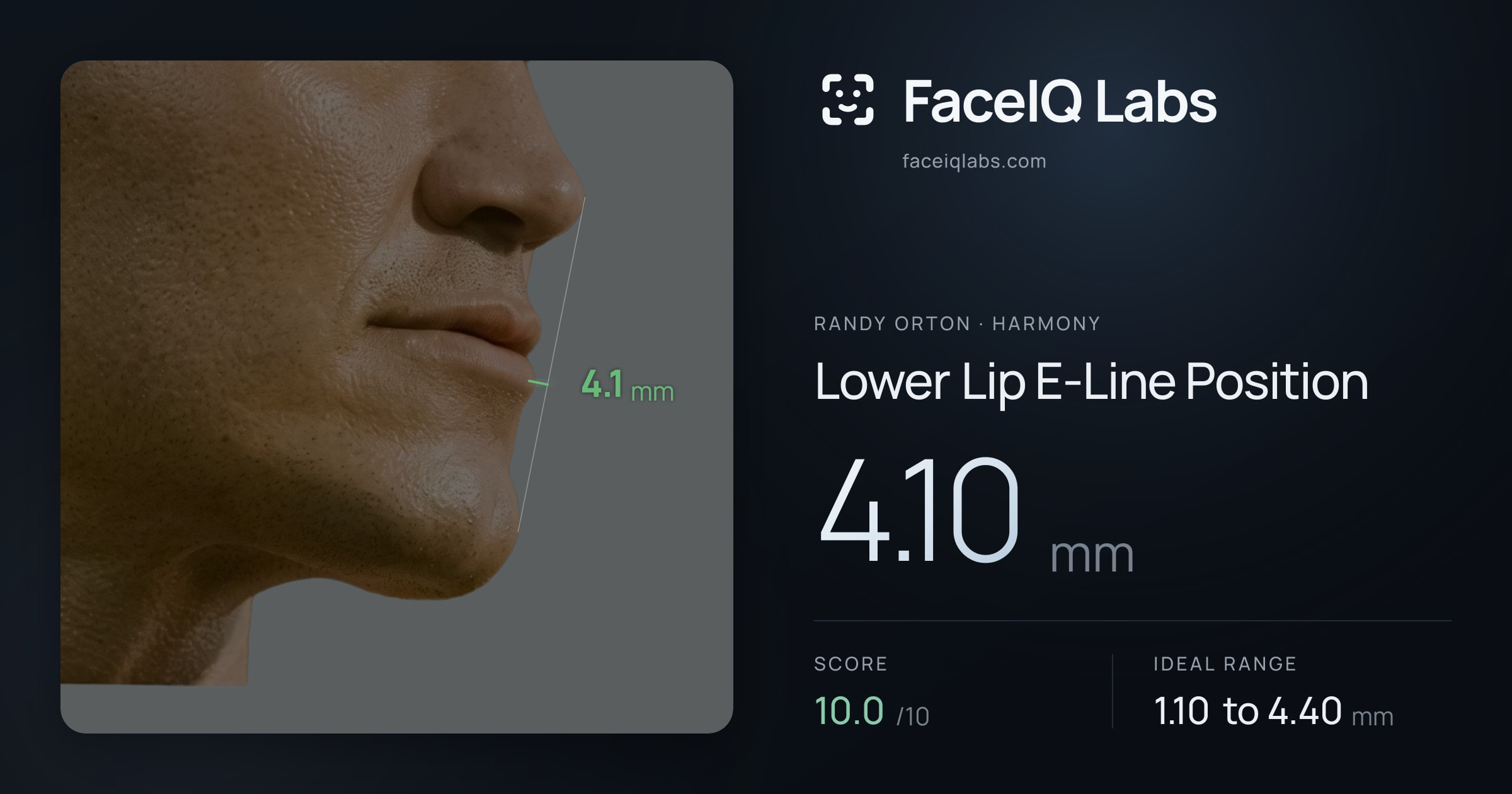 Randy Orton Lower Lip E-Line Position: 4.10mm, drawn on the photo