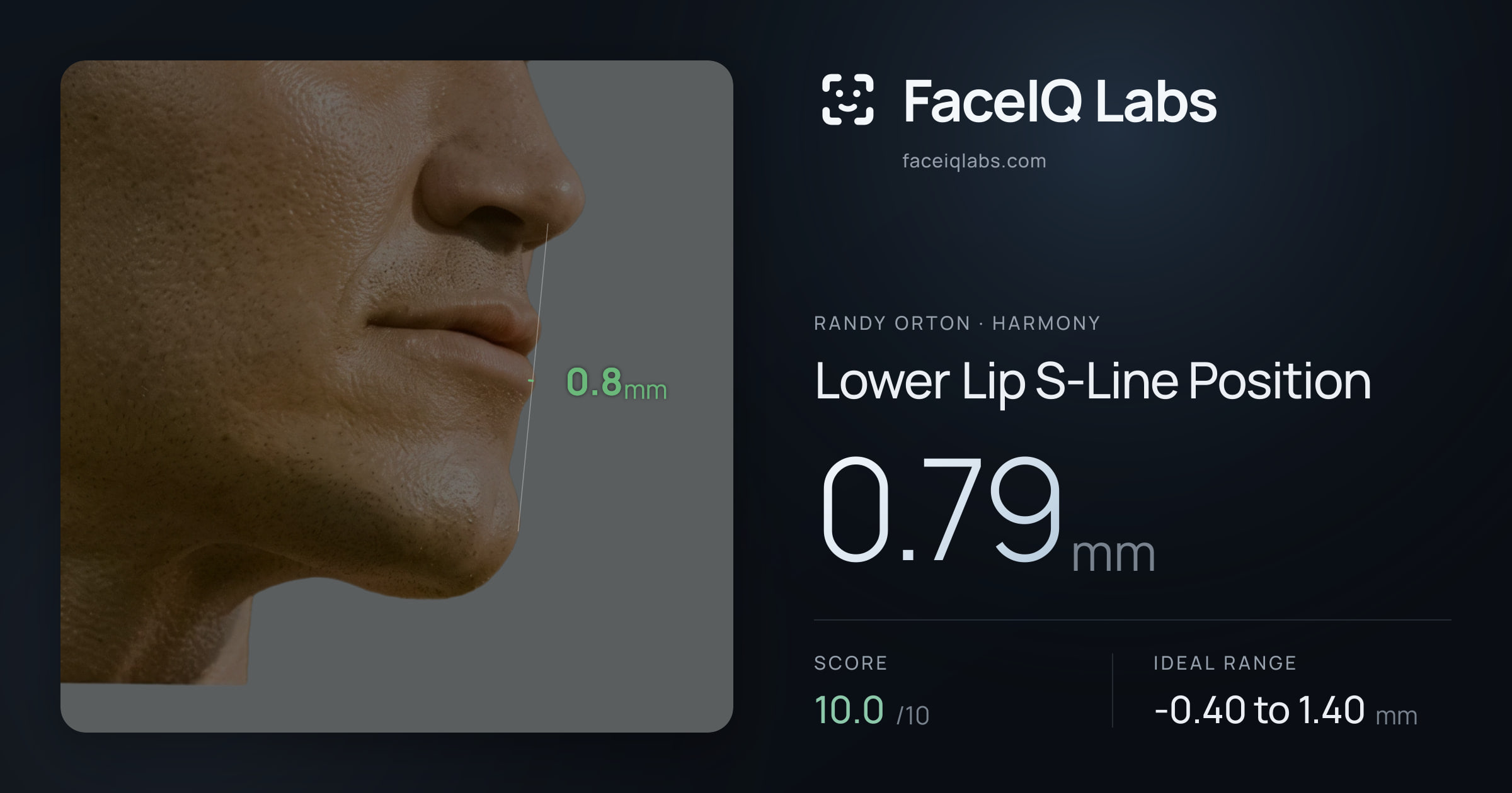 Randy Orton Lower Lip S-Line Position: 0.79mm, drawn on the photo