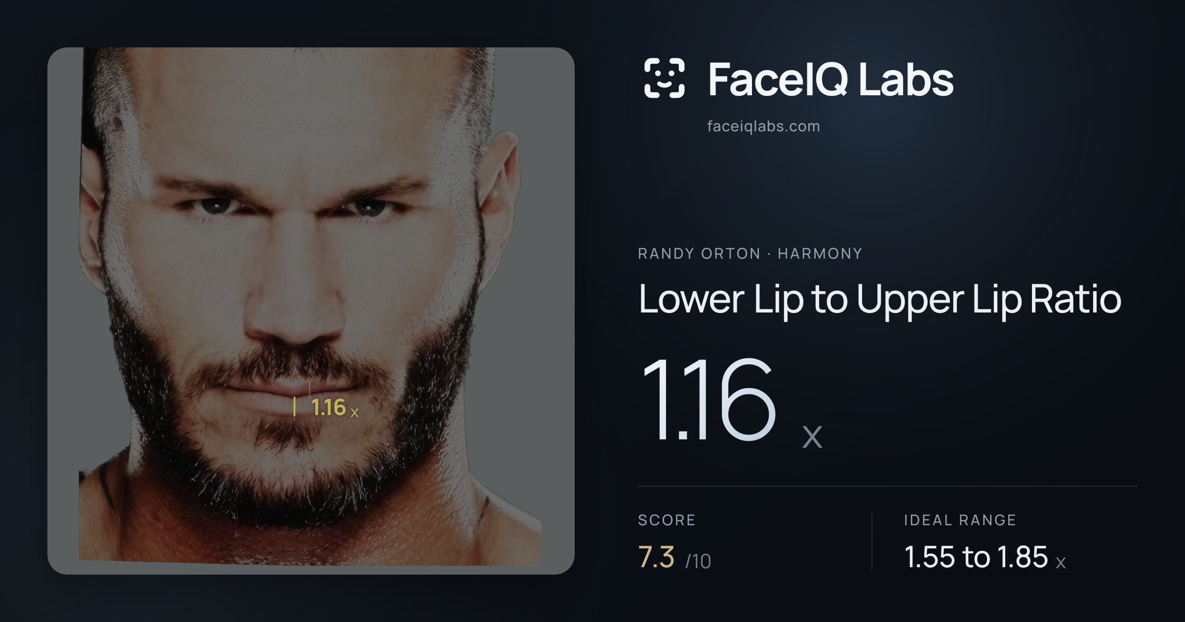 Randy Orton Lower Lip to Upper Lip Ratio: 1.16x, drawn on the photo