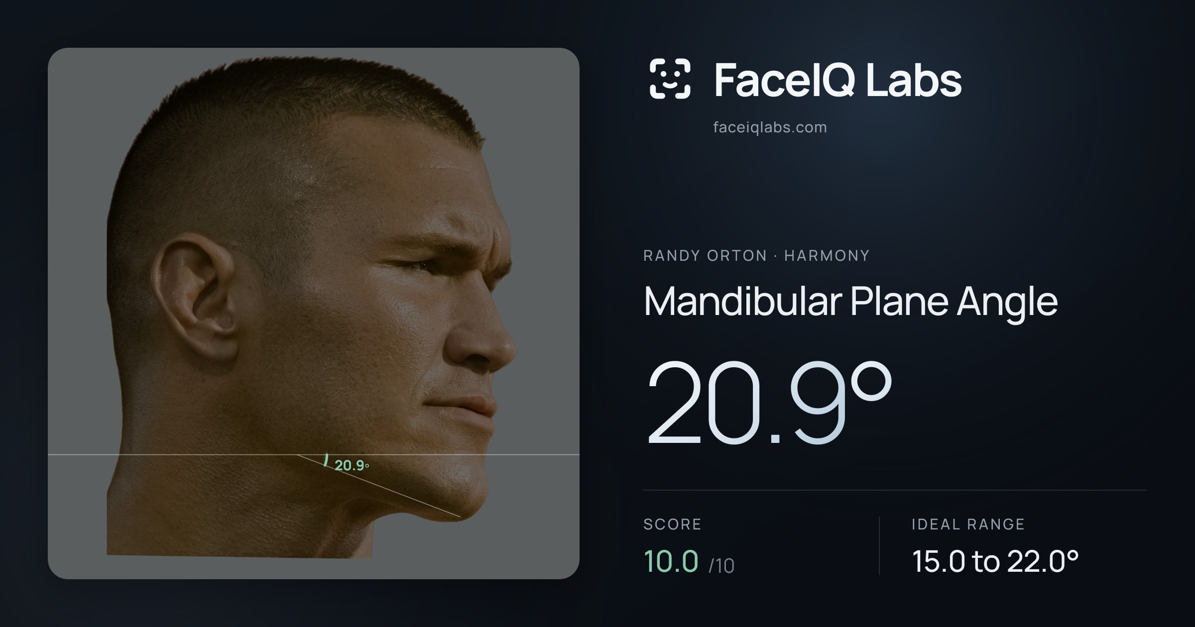 Randy Orton Mandibular Plane Angle: 20.9°, drawn on the photo