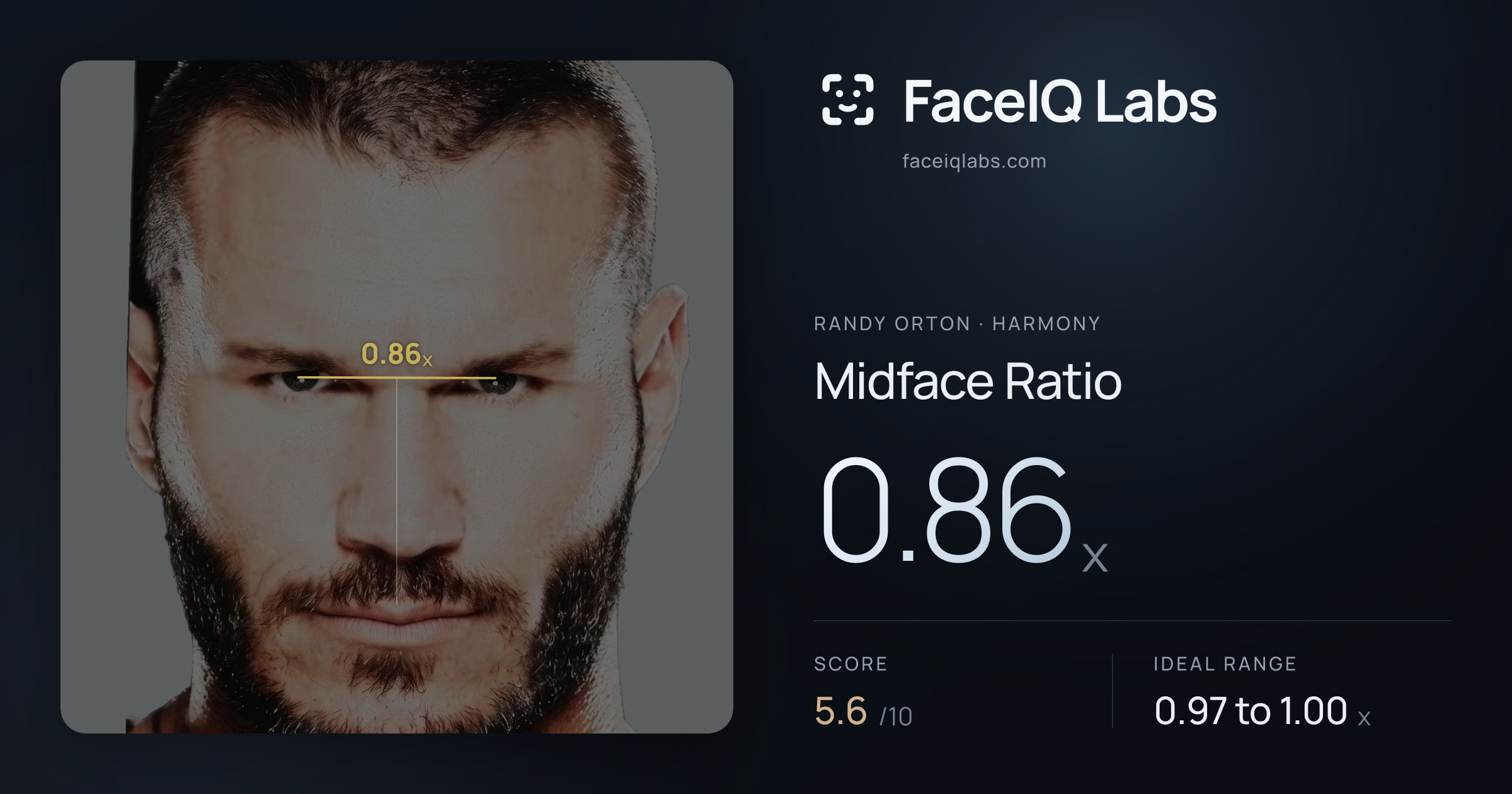 Randy Orton Midface Ratio: 0.86x, drawn on the photo