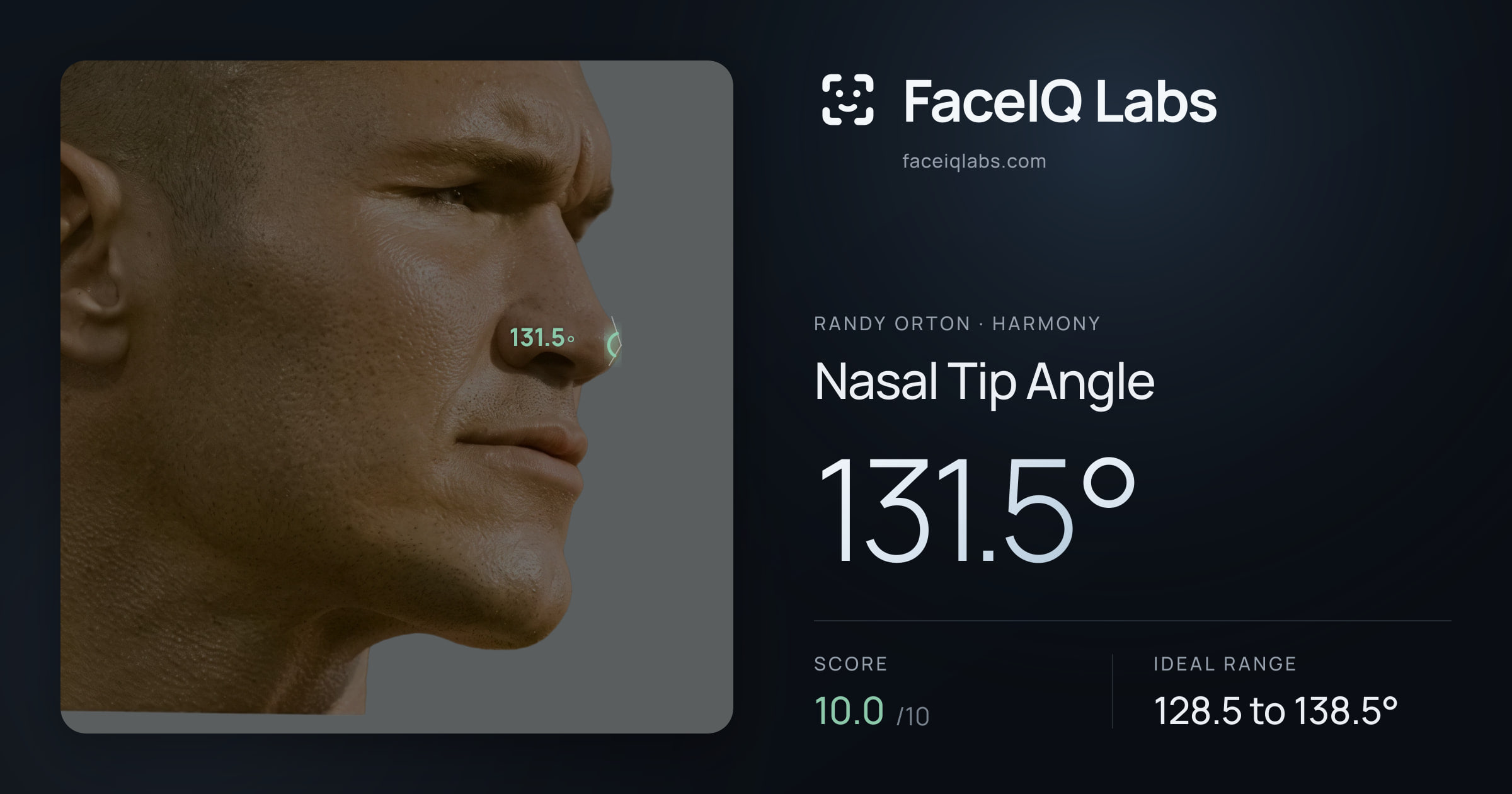 Randy Orton Nasal Tip Angle: 131.5°, drawn on the photo