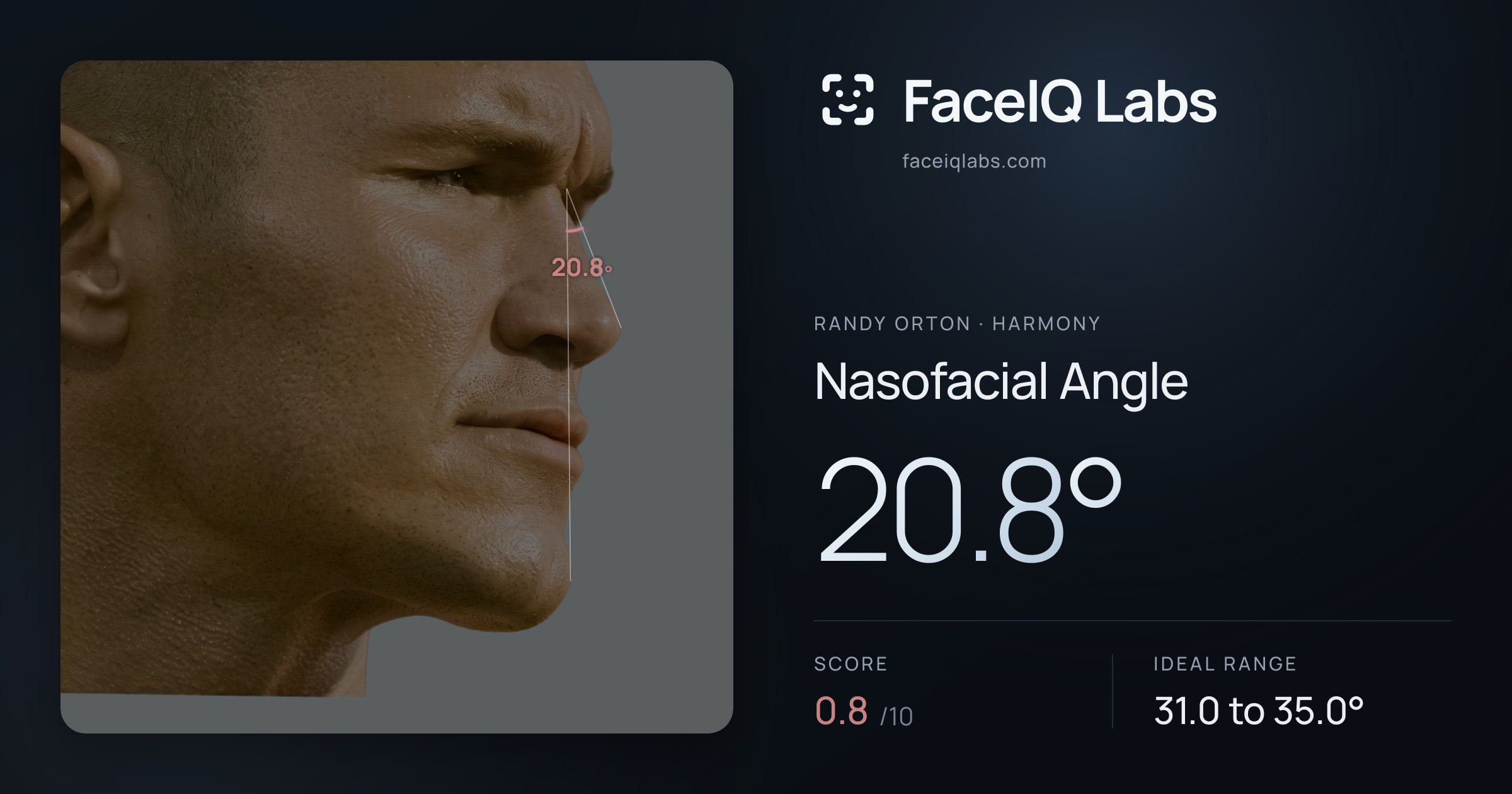 Randy Orton Nasofacial Angle: 20.8°, drawn on the photo