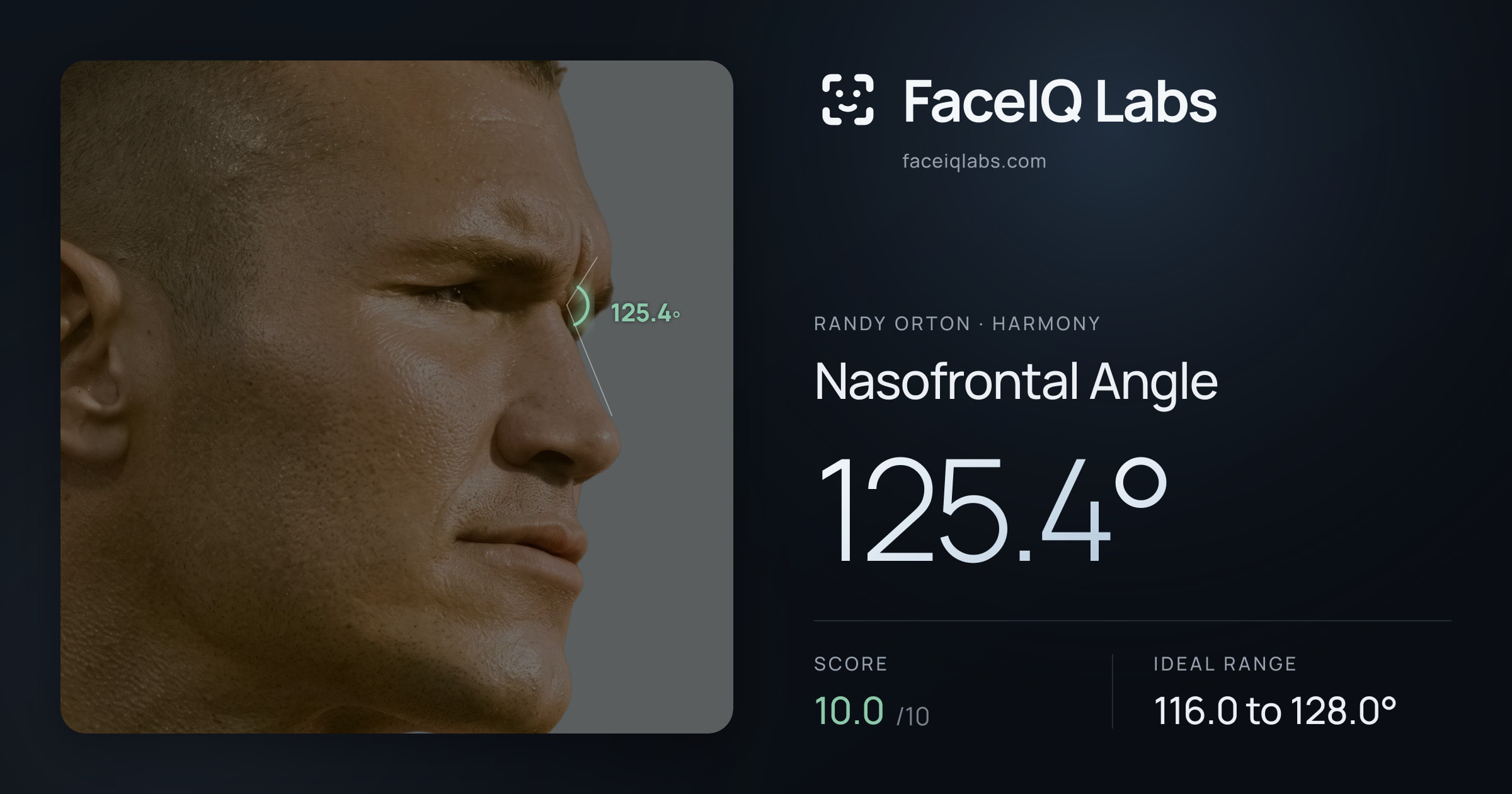Randy Orton Nasofrontal Angle: 125.4°, drawn on the photo