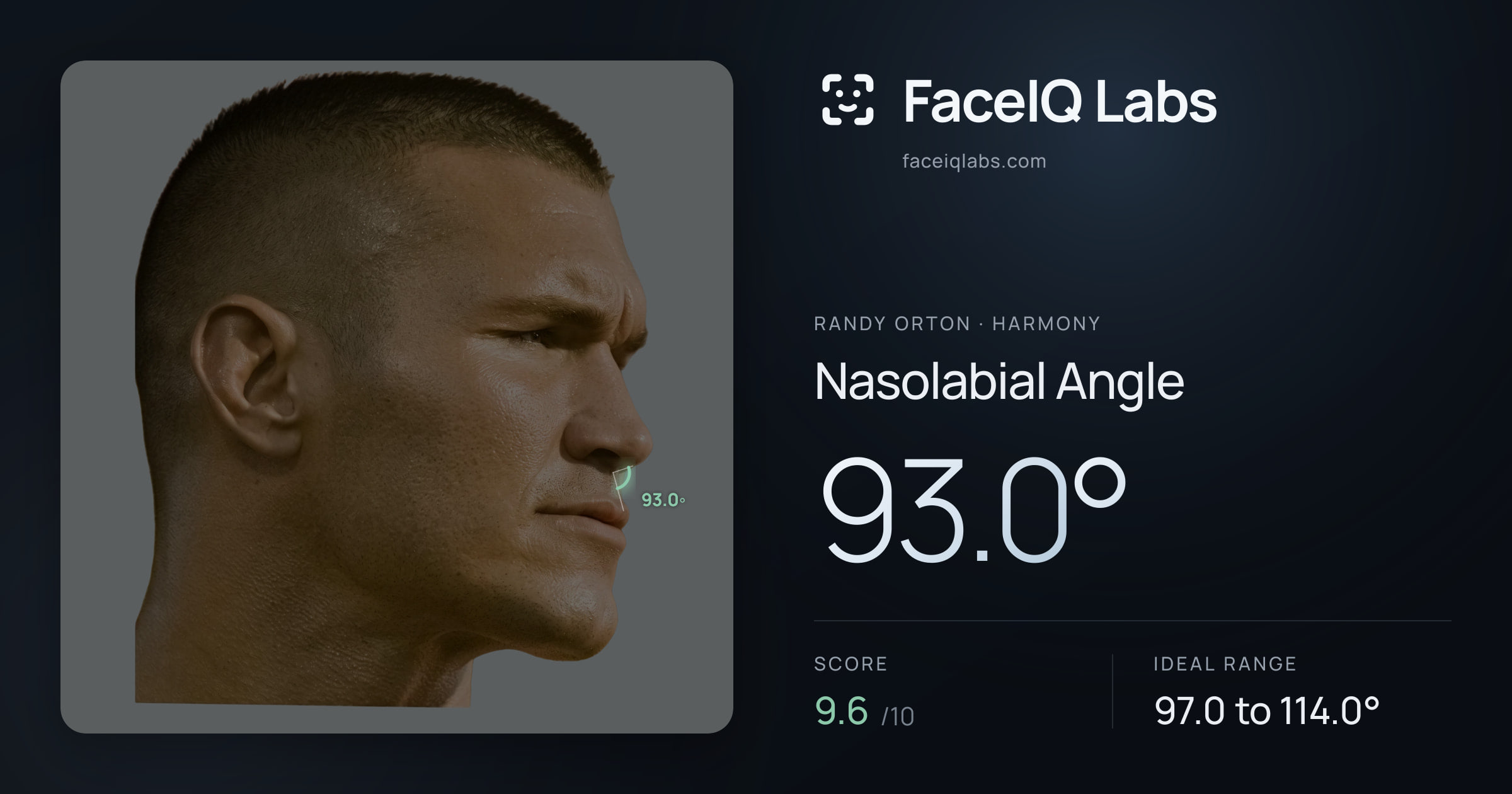 Randy Orton Nasolabial Angle: 93.0°, drawn on the photo