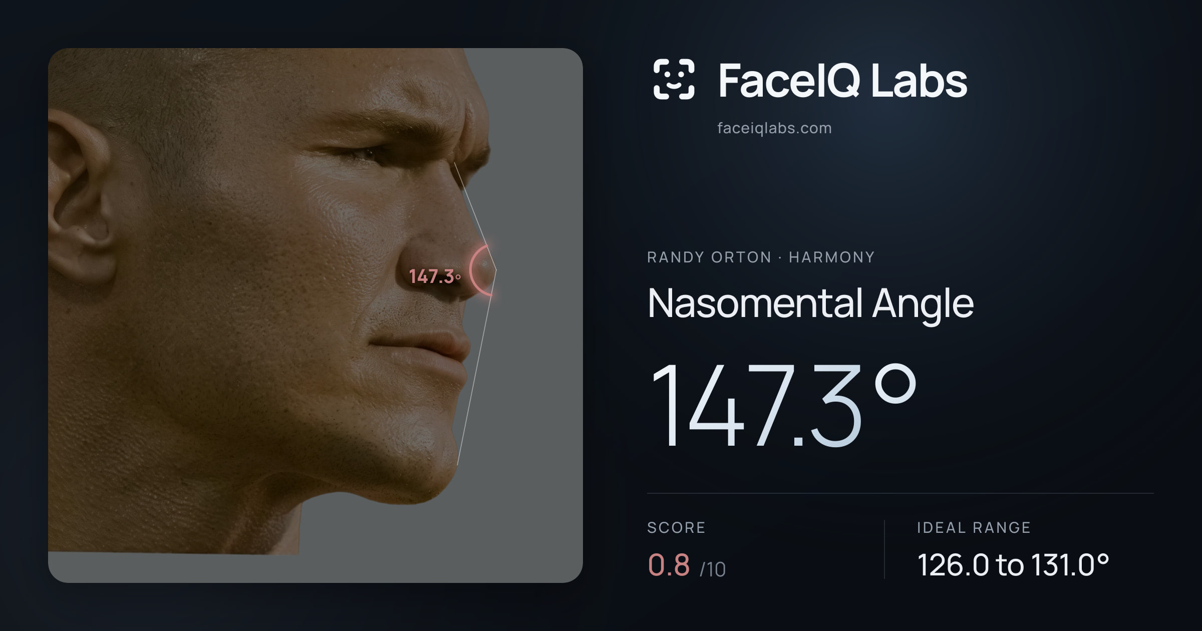 Randy Orton Nasomental Angle: 147.3°, drawn on the photo