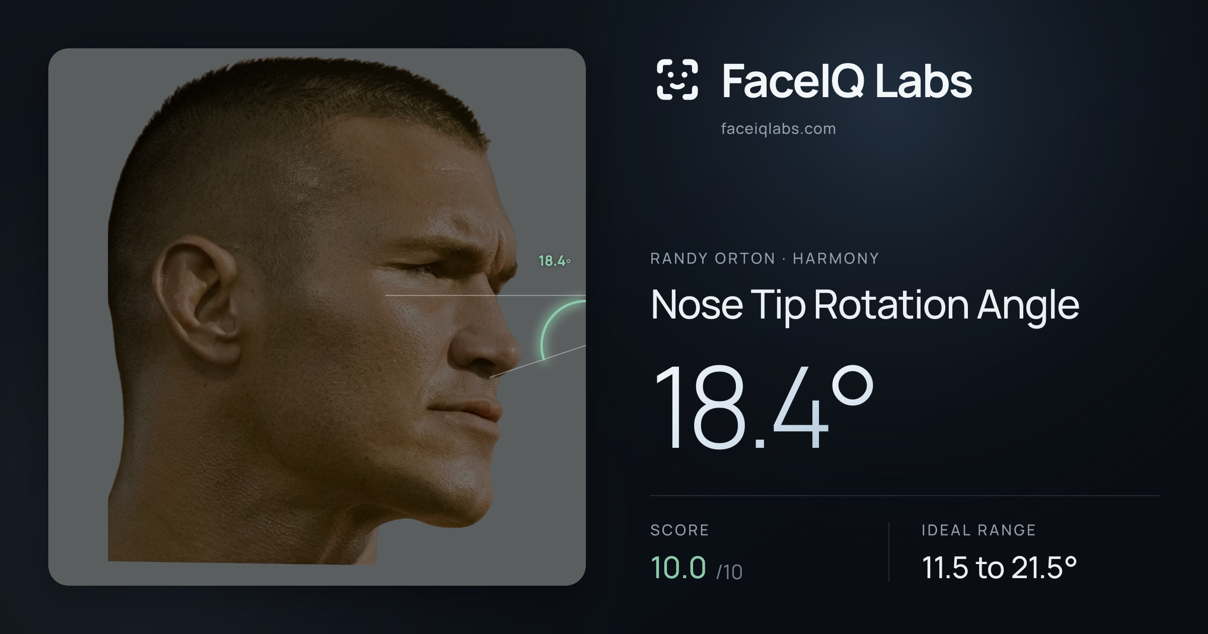 Randy Orton Nose Tip Rotation Angle: 18.4°, drawn on the photo