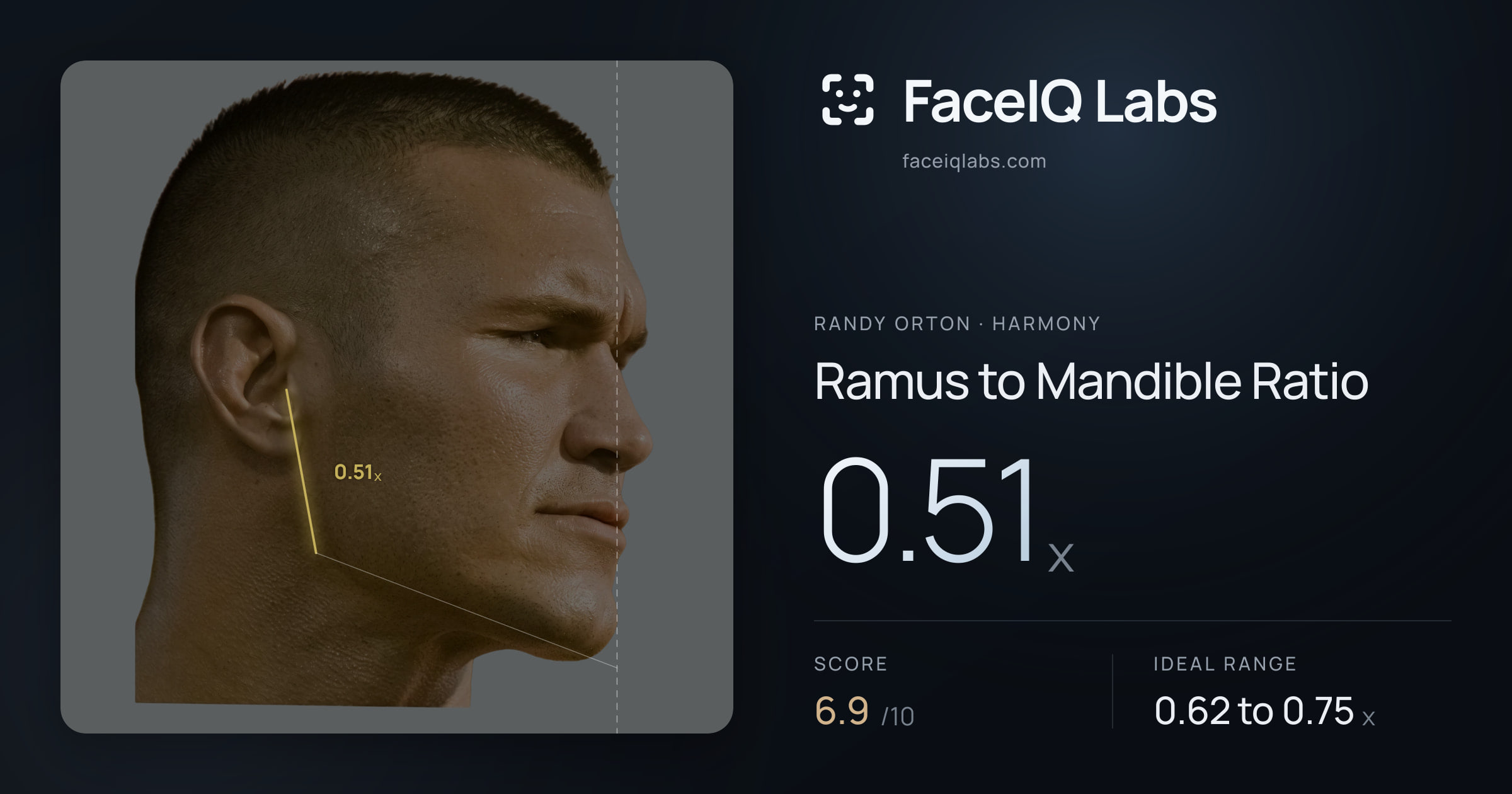 Randy Orton Ramus to Mandible Ratio: 0.51x, drawn on the photo