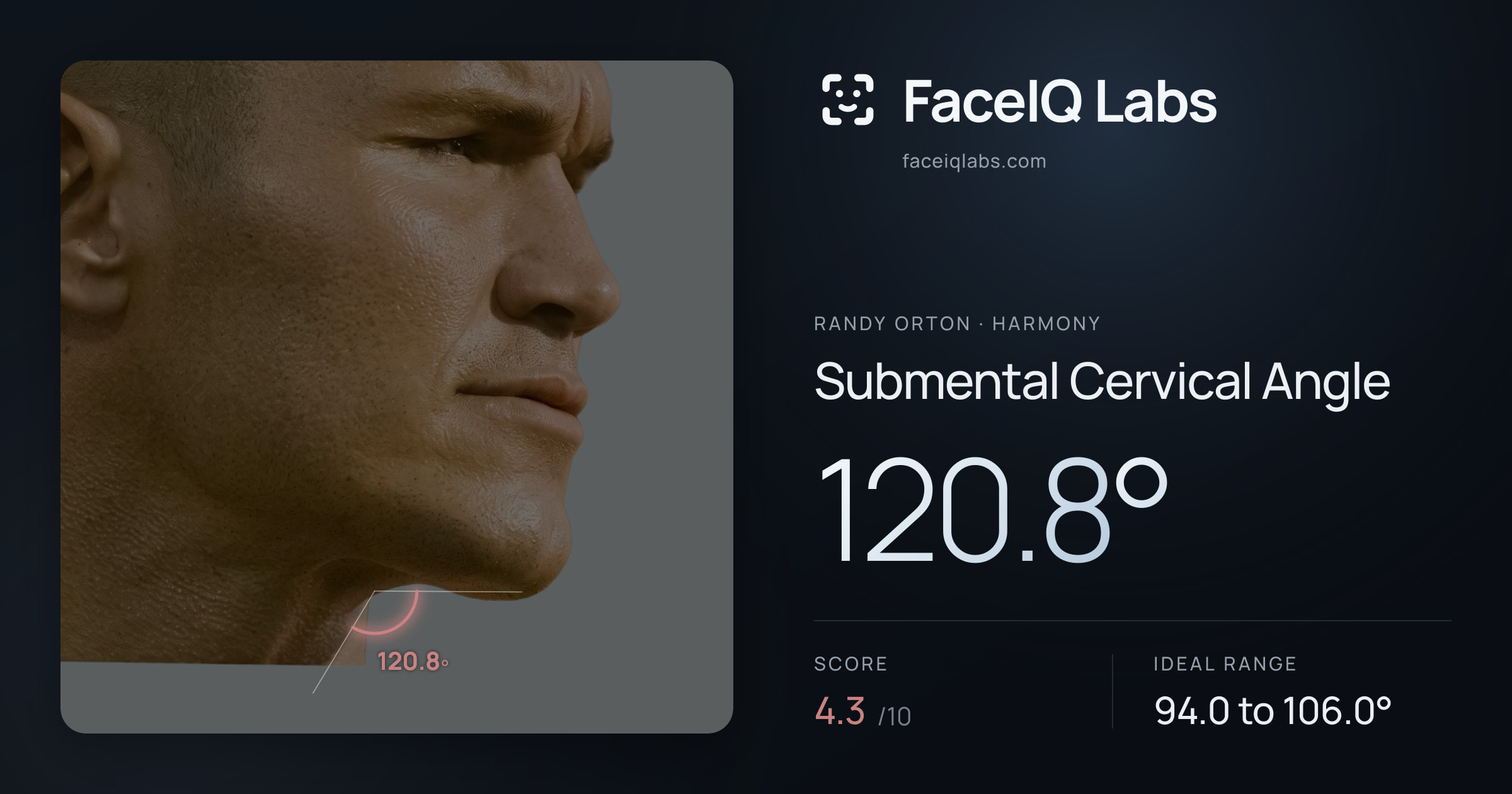Randy Orton Submental Cervical Angle: 120.8°, drawn on the photo