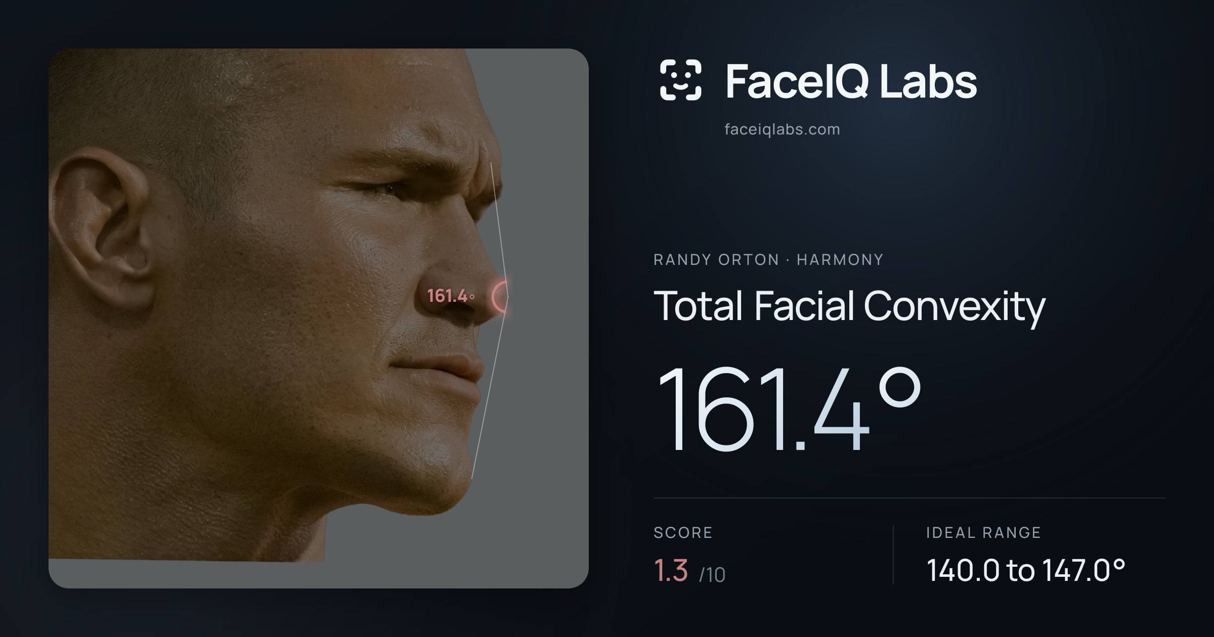 Randy Orton Total Facial Convexity: 161.4°, drawn on the photo