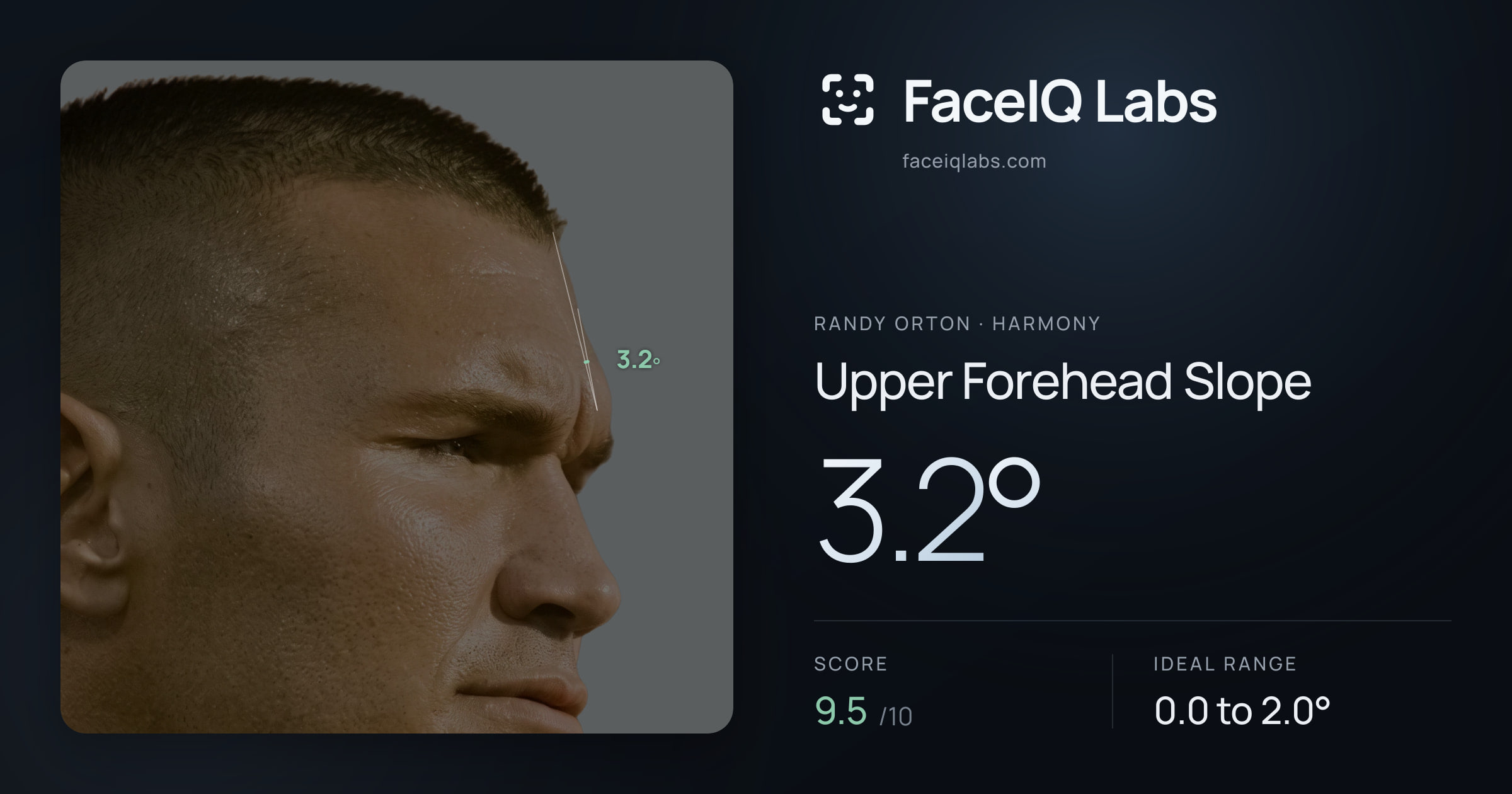 Randy Orton Upper Forehead Slope: 3.2°, drawn on the photo