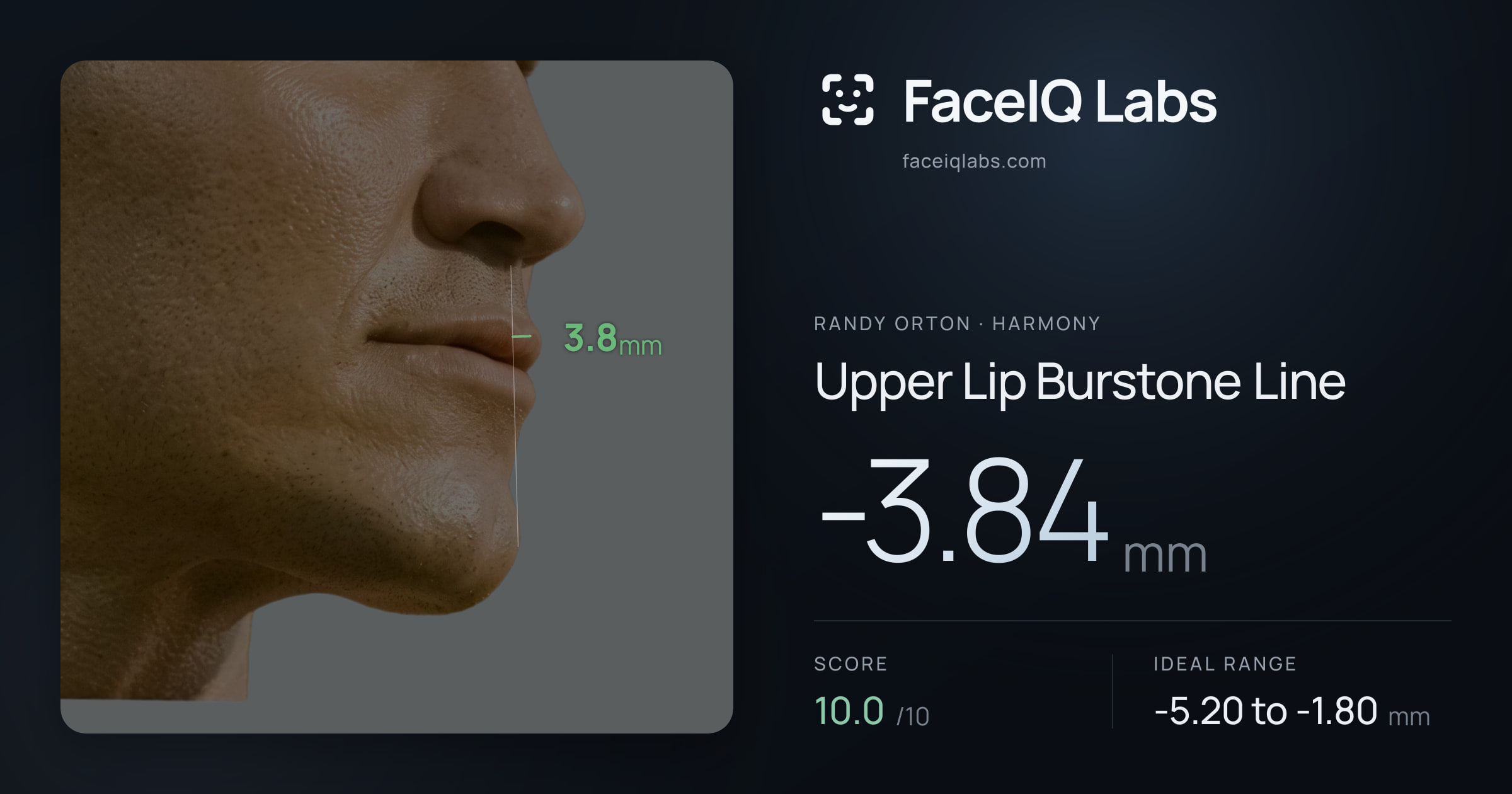 Randy Orton Upper Lip Burstone Line: -3.84mm, drawn on the photo