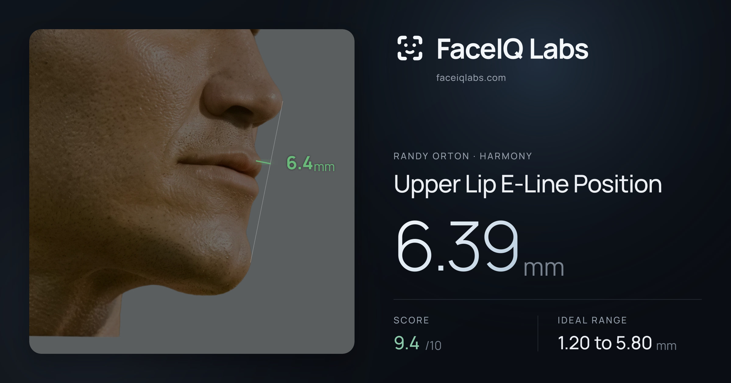 Randy Orton Upper Lip E-Line Position: 6.39mm, drawn on the photo