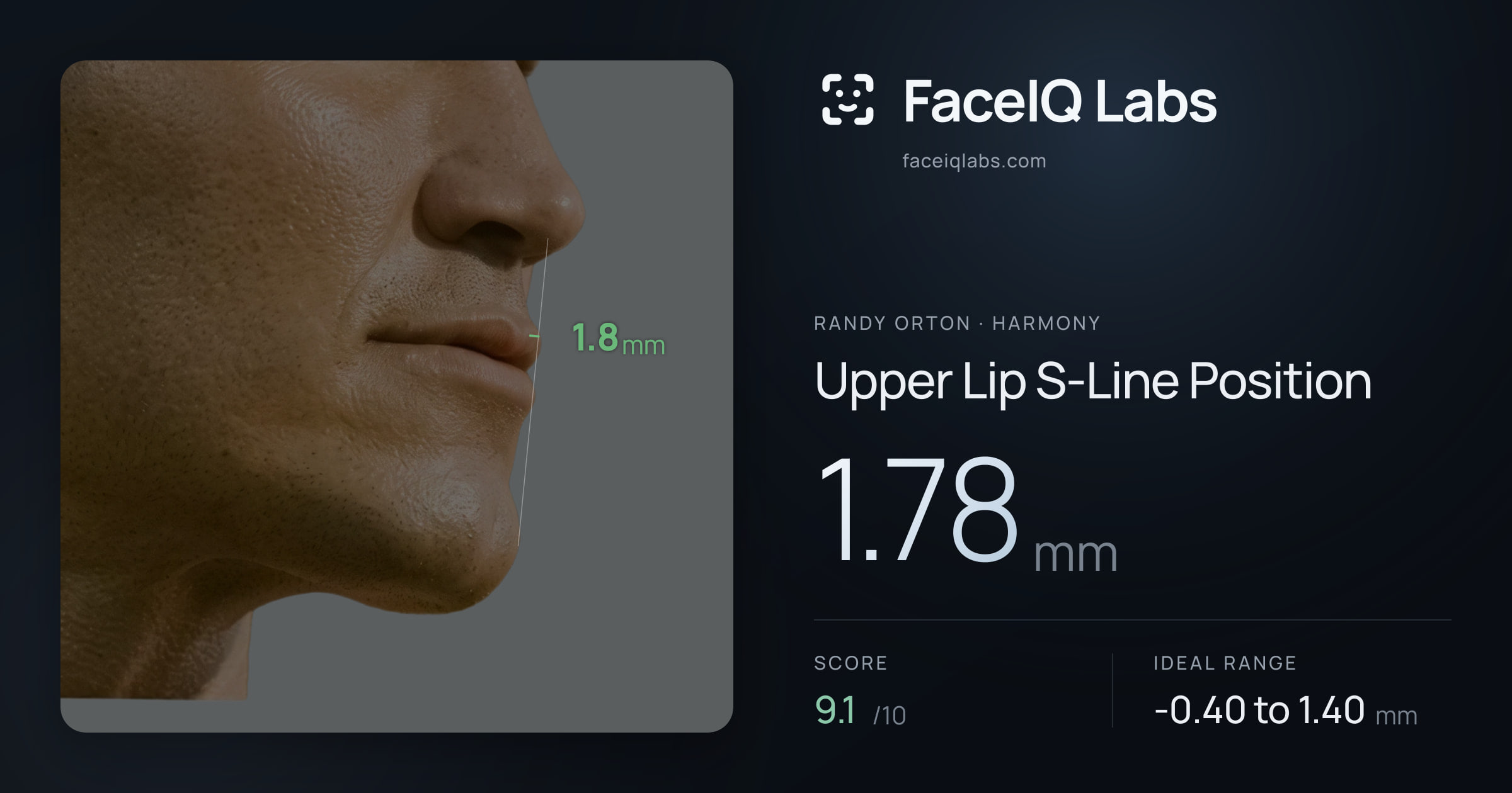 Randy Orton Upper Lip S-Line Position: 1.78mm, drawn on the photo