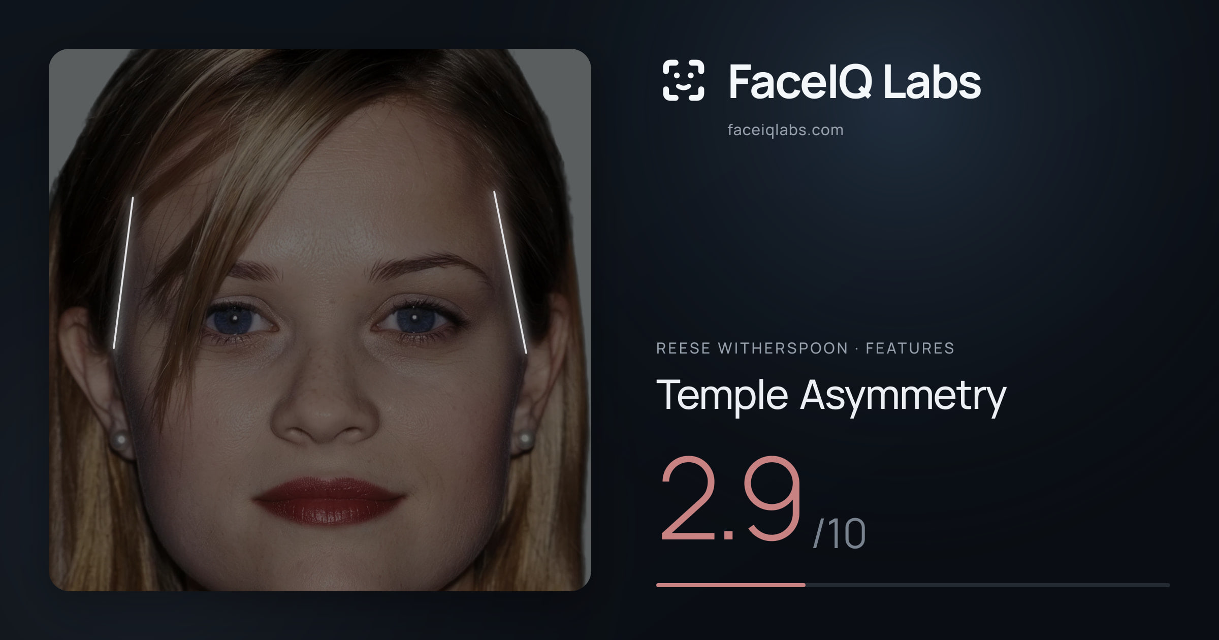 Reese Witherspoon Temple Asymmetry: 2.9/10, drawn on the photo