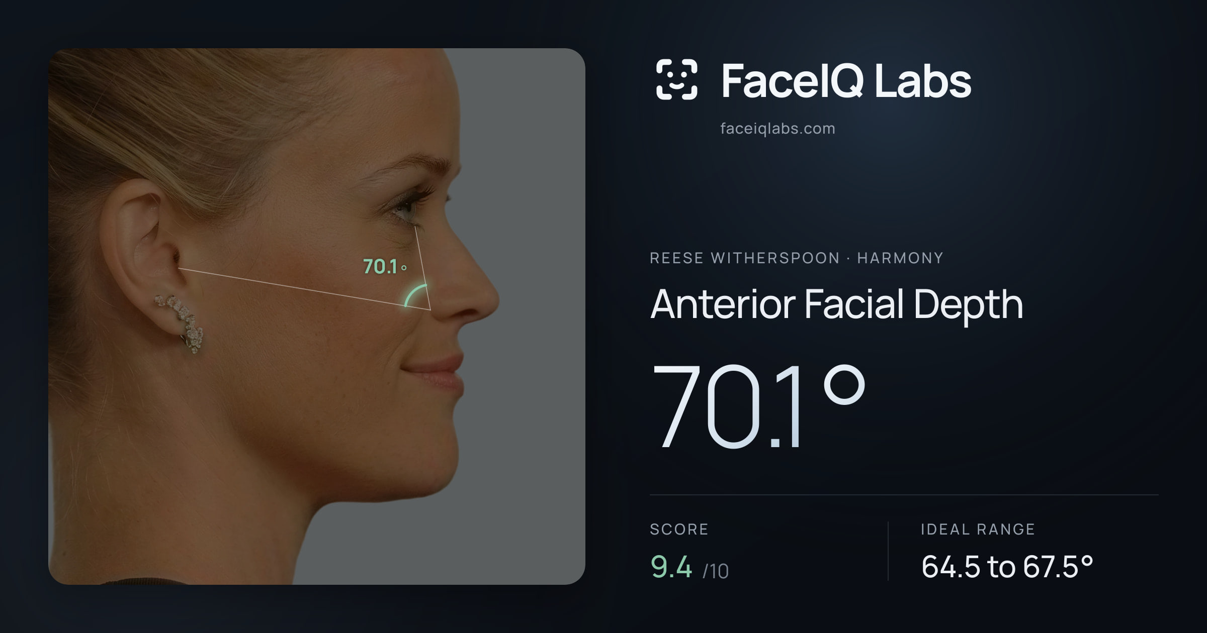 Reese Witherspoon Anterior Facial Depth: 70.1°, drawn on the photo