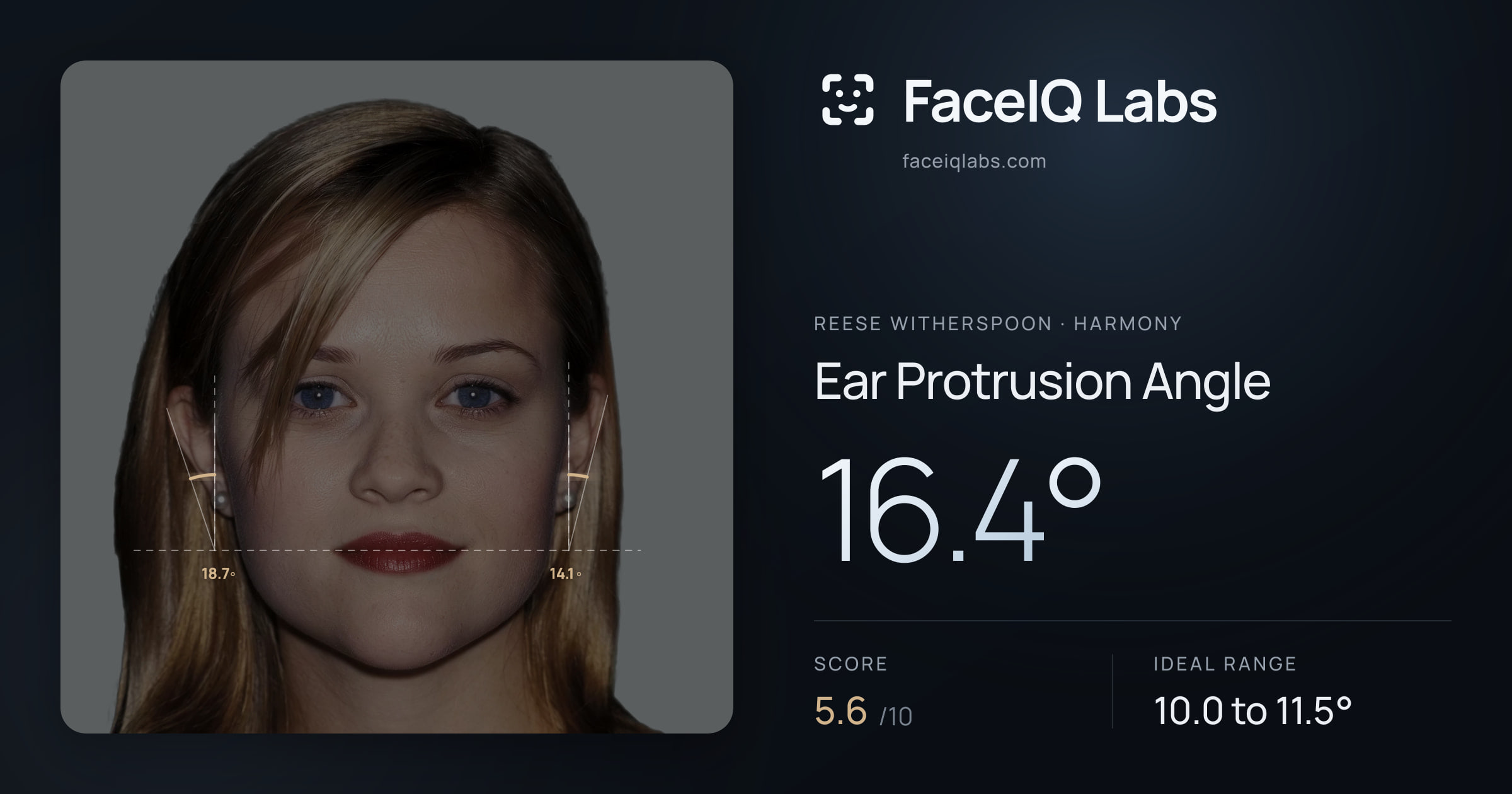 Reese Witherspoon Ear Protrusion Angle: 16.4°, drawn on the photo