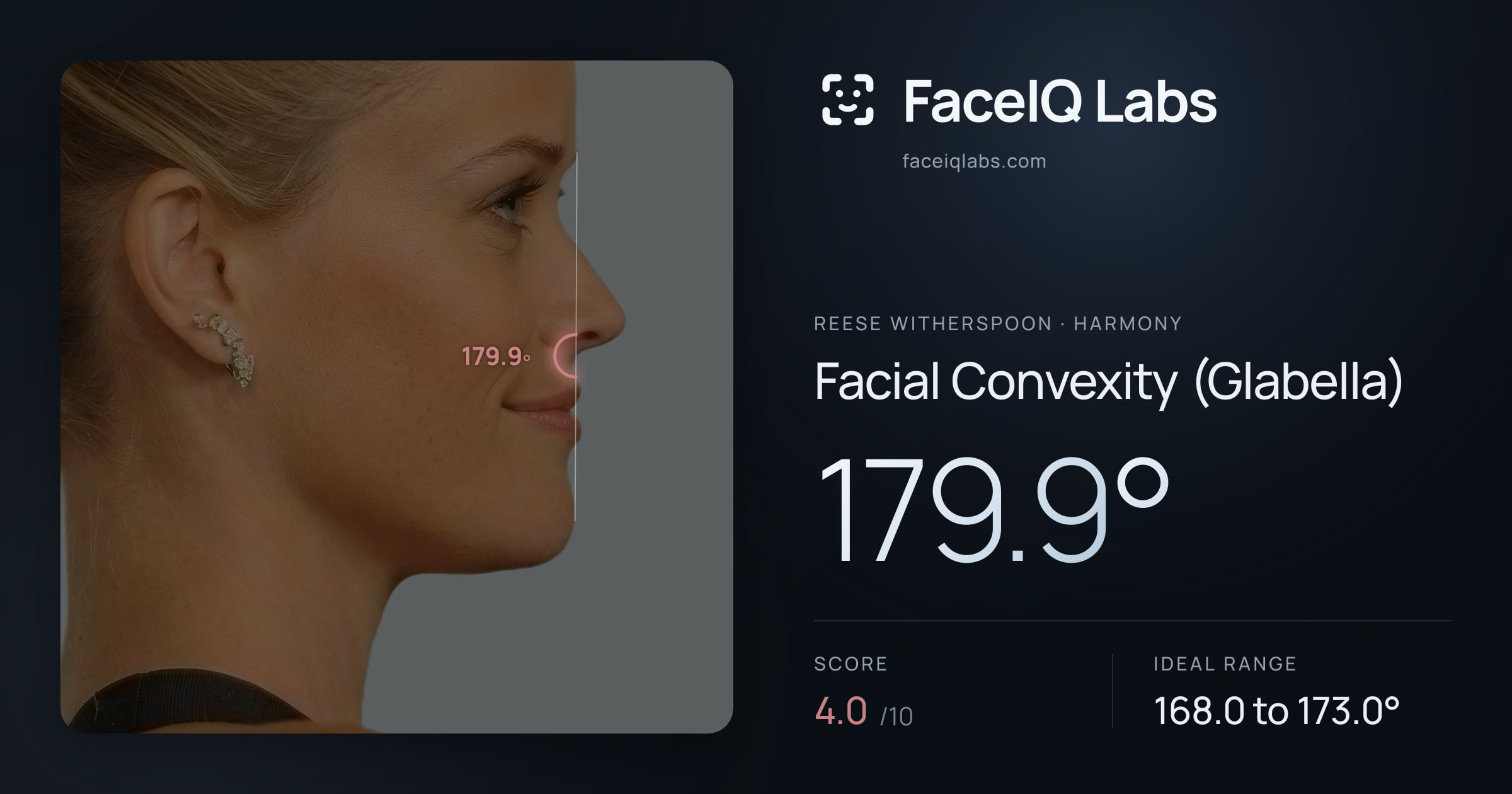 Reese Witherspoon Facial Convexity (Glabella): 179.9°, drawn on the photo