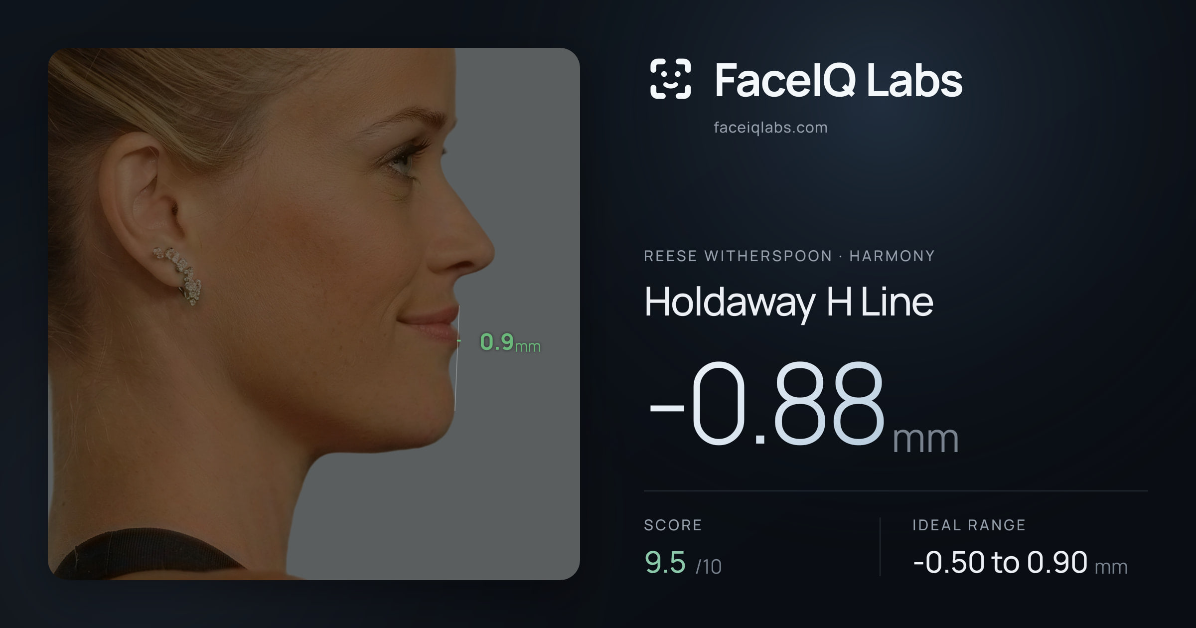 Reese Witherspoon Holdaway H Line: -0.88mm, drawn on the photo