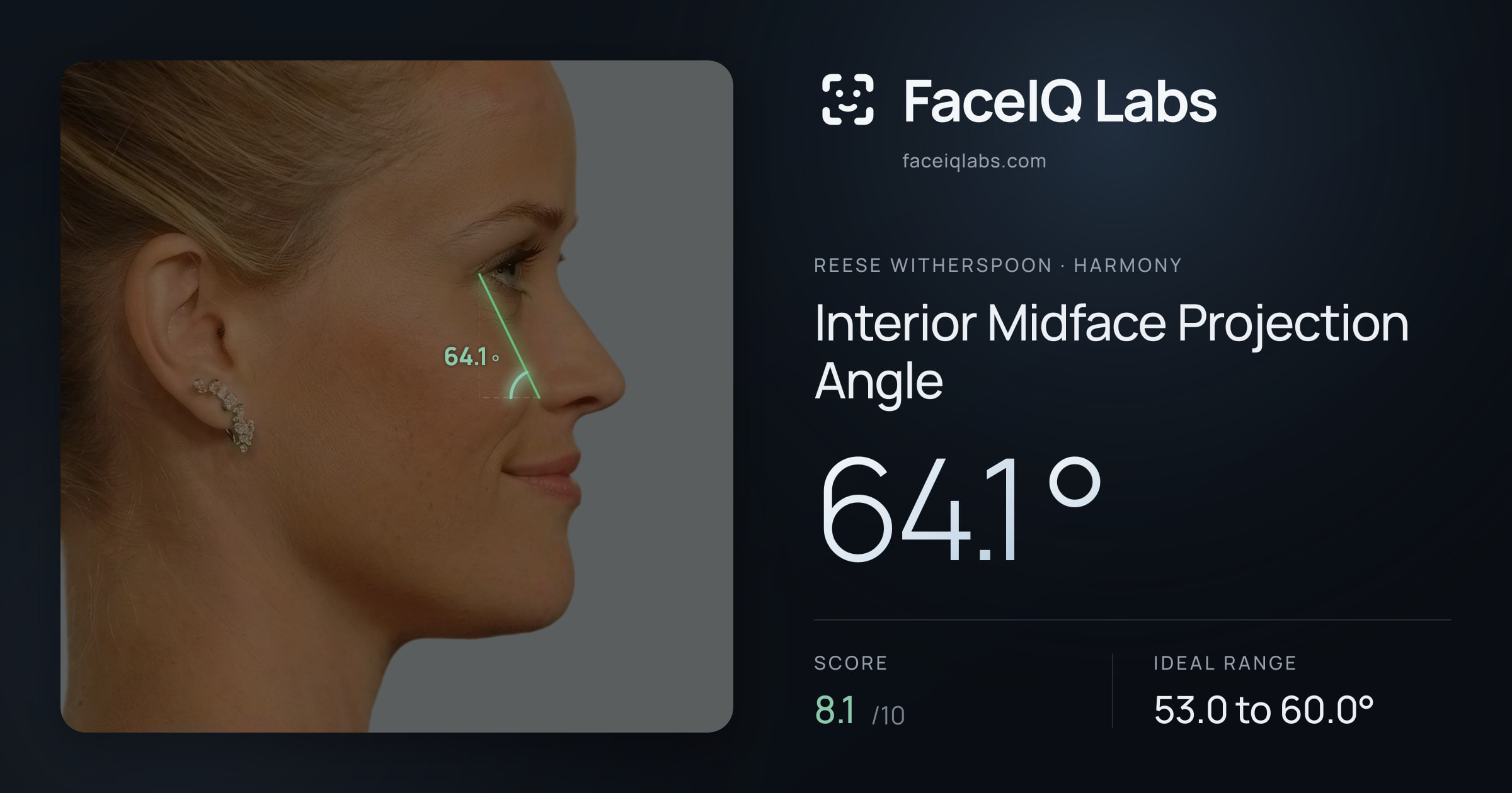 Reese Witherspoon Interior Midface Projection Angle: 64.1°, drawn on the photo