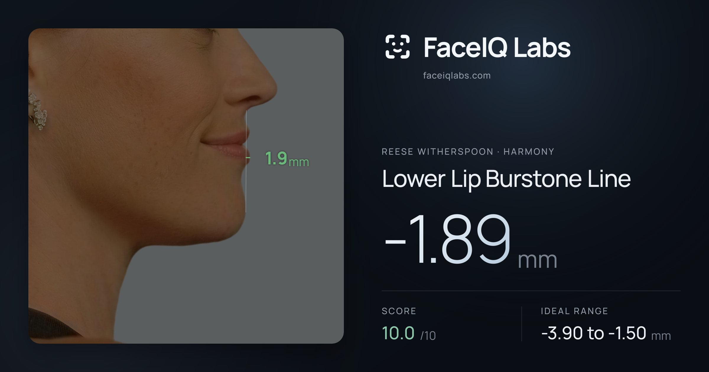 Reese Witherspoon Lower Lip Burstone Line: -1.89mm, drawn on the photo