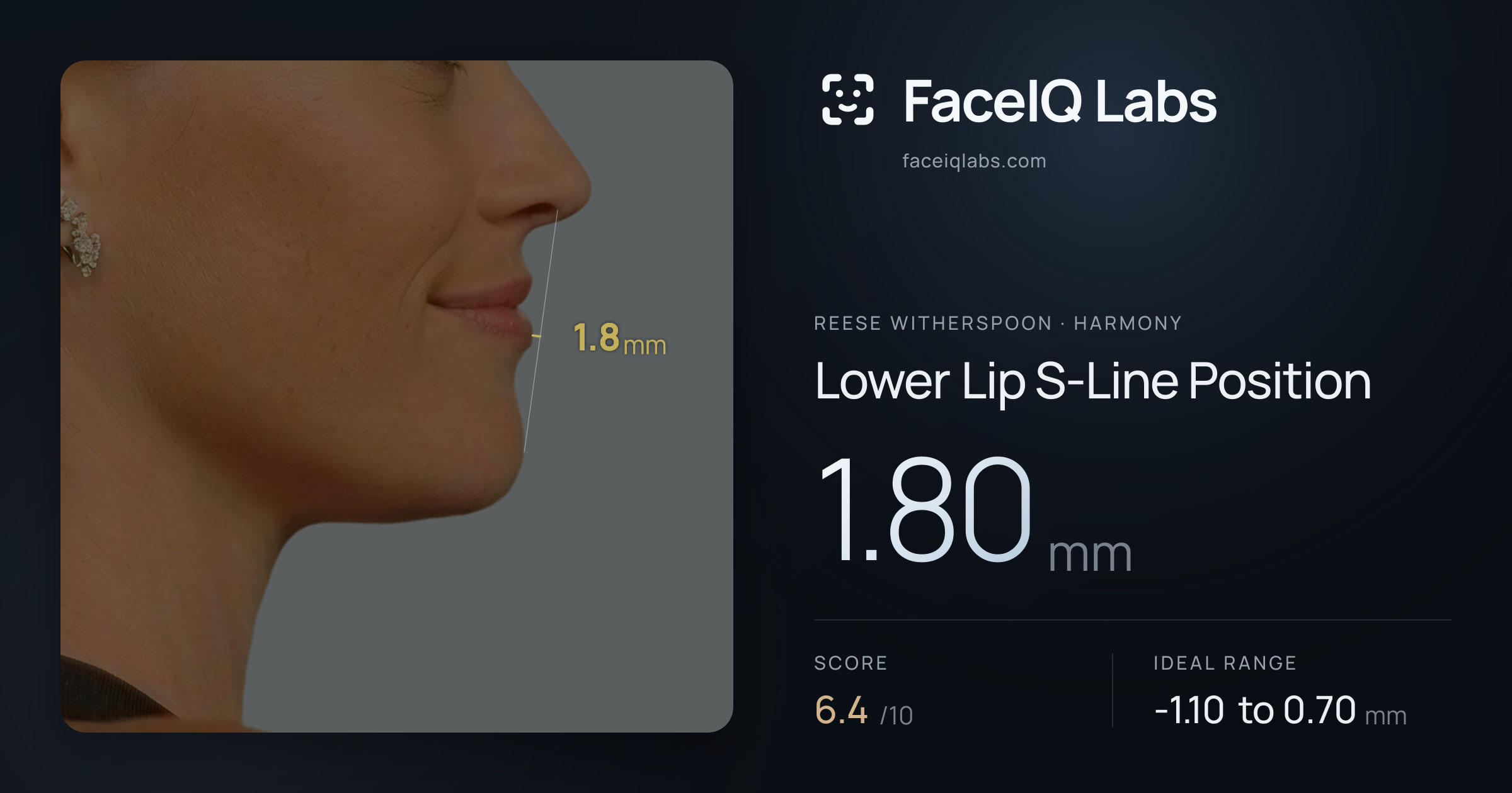 Reese Witherspoon Lower Lip S-Line Position: 1.80mm, drawn on the photo