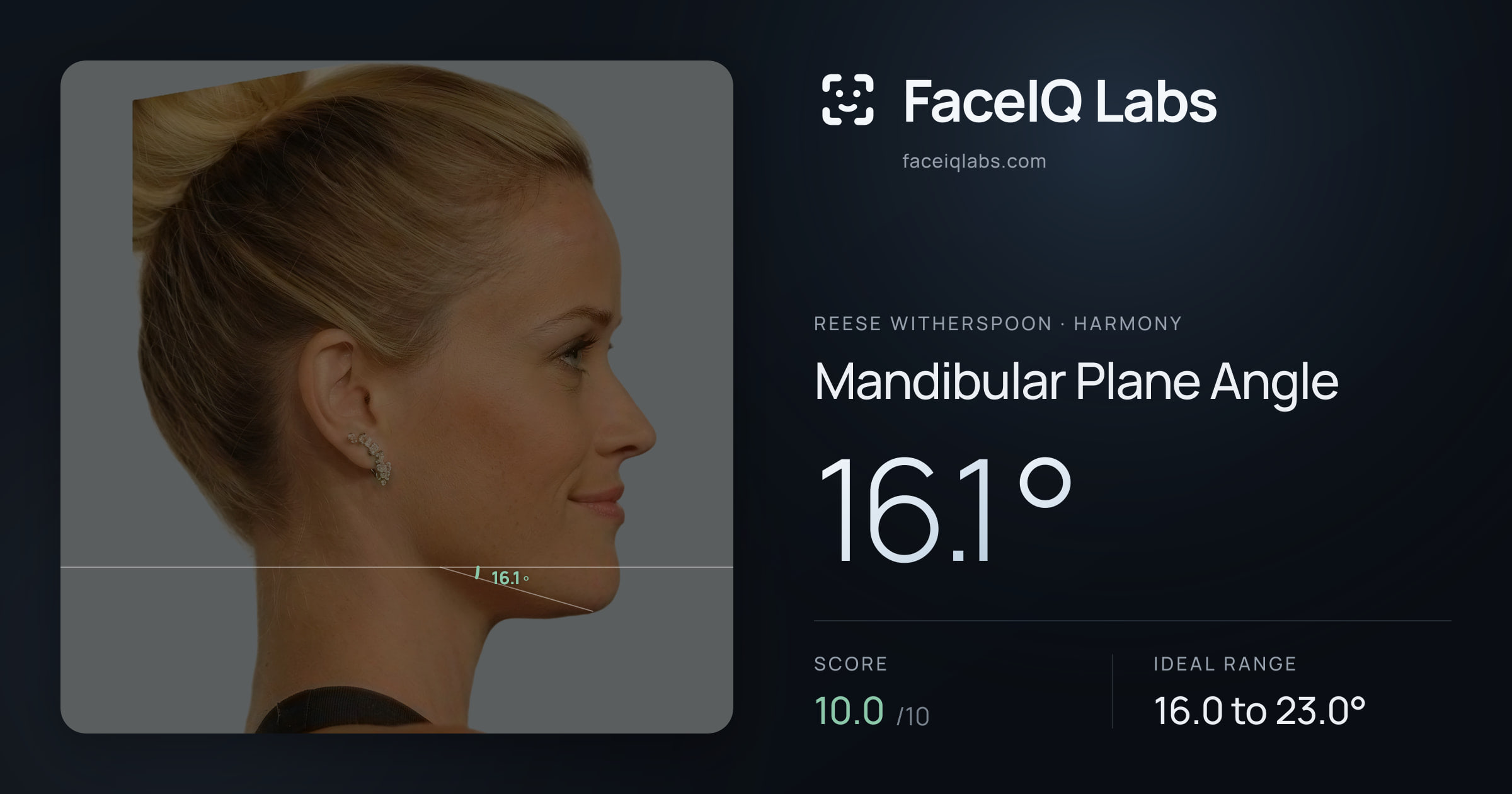 Reese Witherspoon Mandibular Plane Angle: 16.1°, drawn on the photo