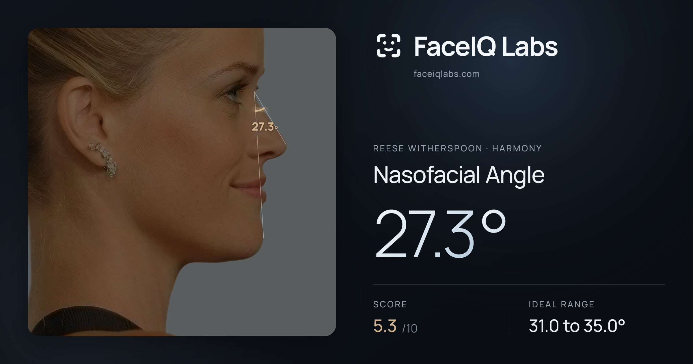 Reese Witherspoon Nasofacial Angle: 27.3°, drawn on the photo