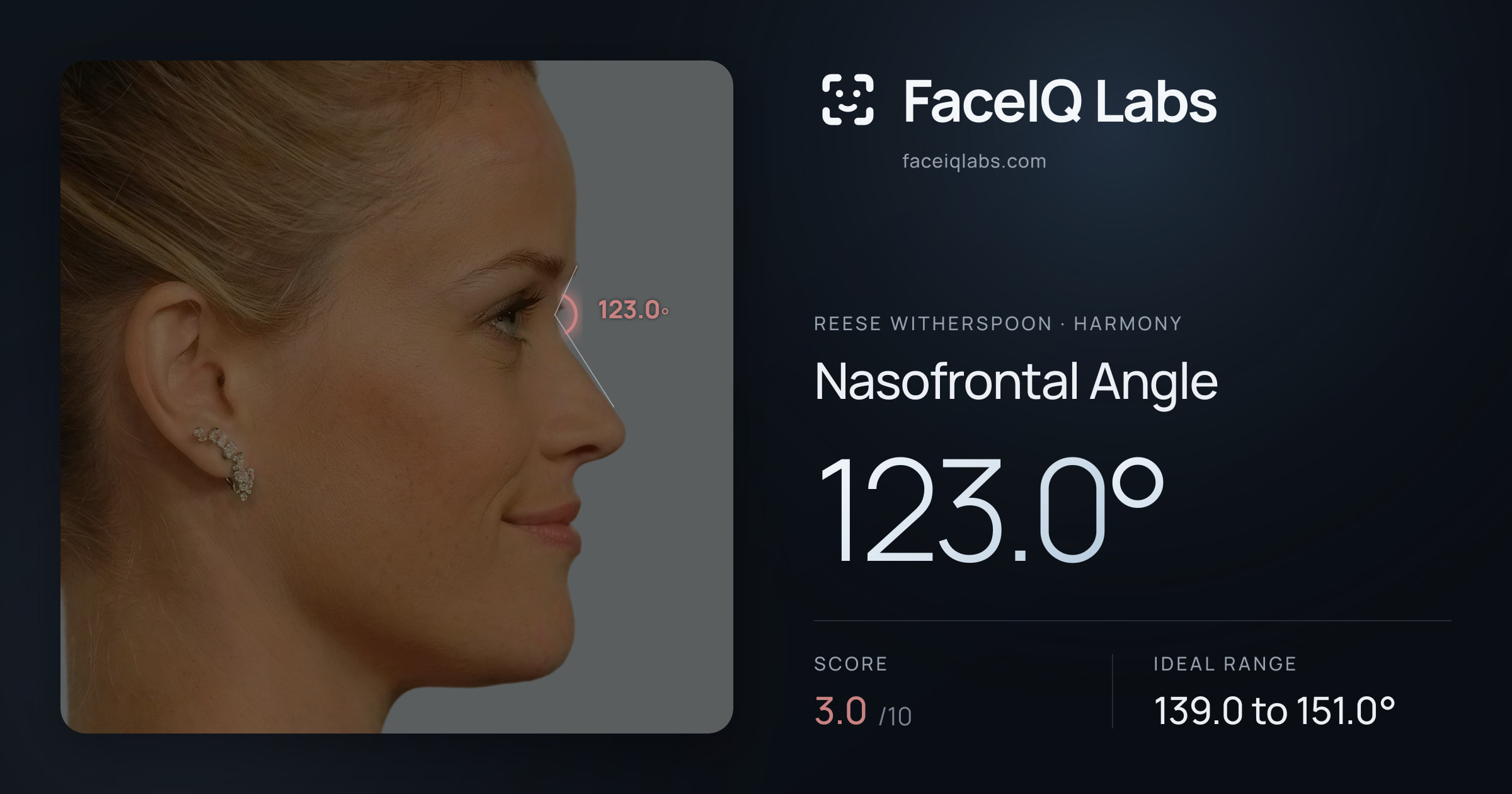 Reese Witherspoon Nasofrontal Angle: 123.0°, drawn on the photo