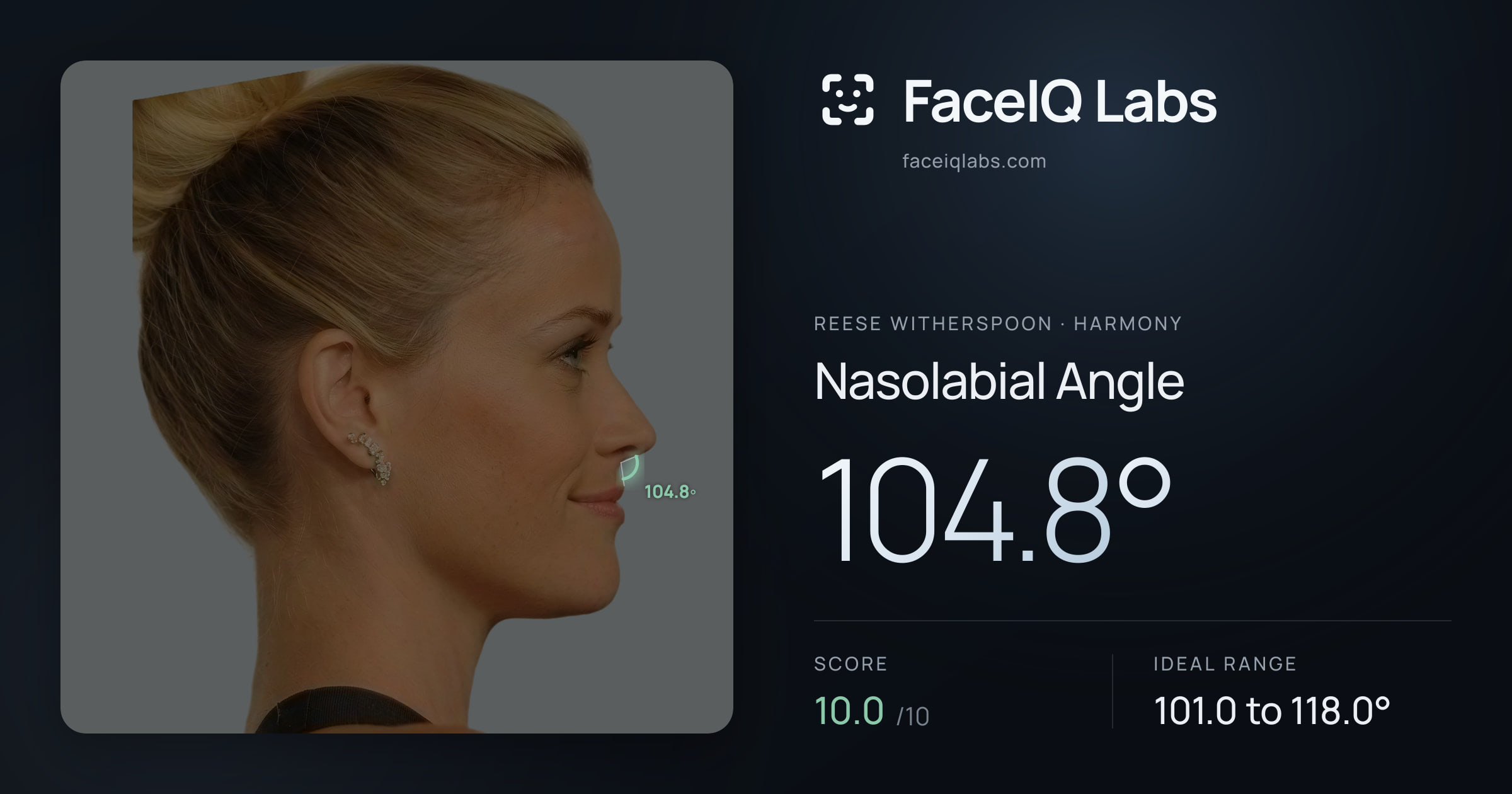 Reese Witherspoon Nasolabial Angle: 104.8°, drawn on the photo