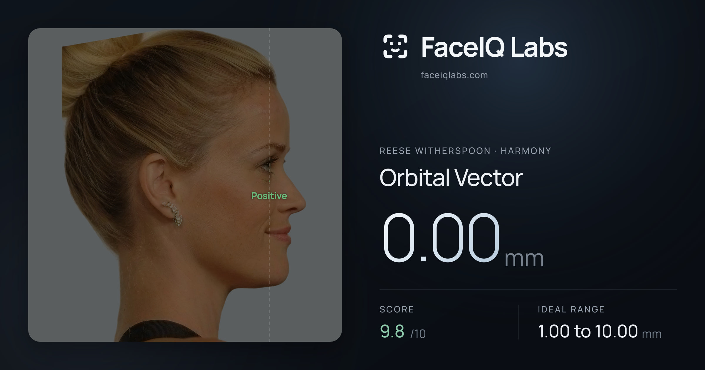 Reese Witherspoon Orbital Vector: 0.00mm, drawn on the photo