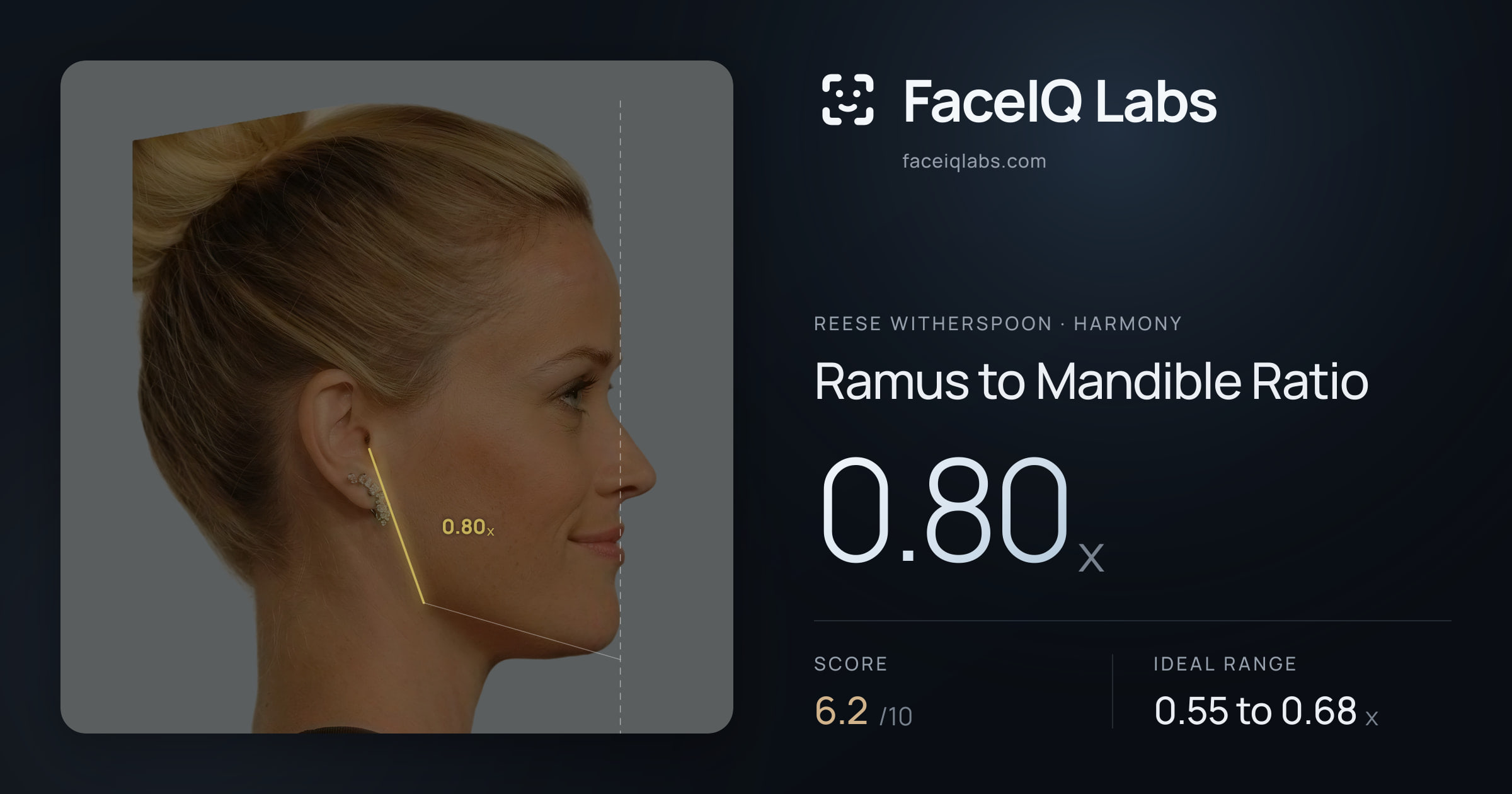 Reese Witherspoon Ramus to Mandible Ratio: 0.80x, drawn on the photo