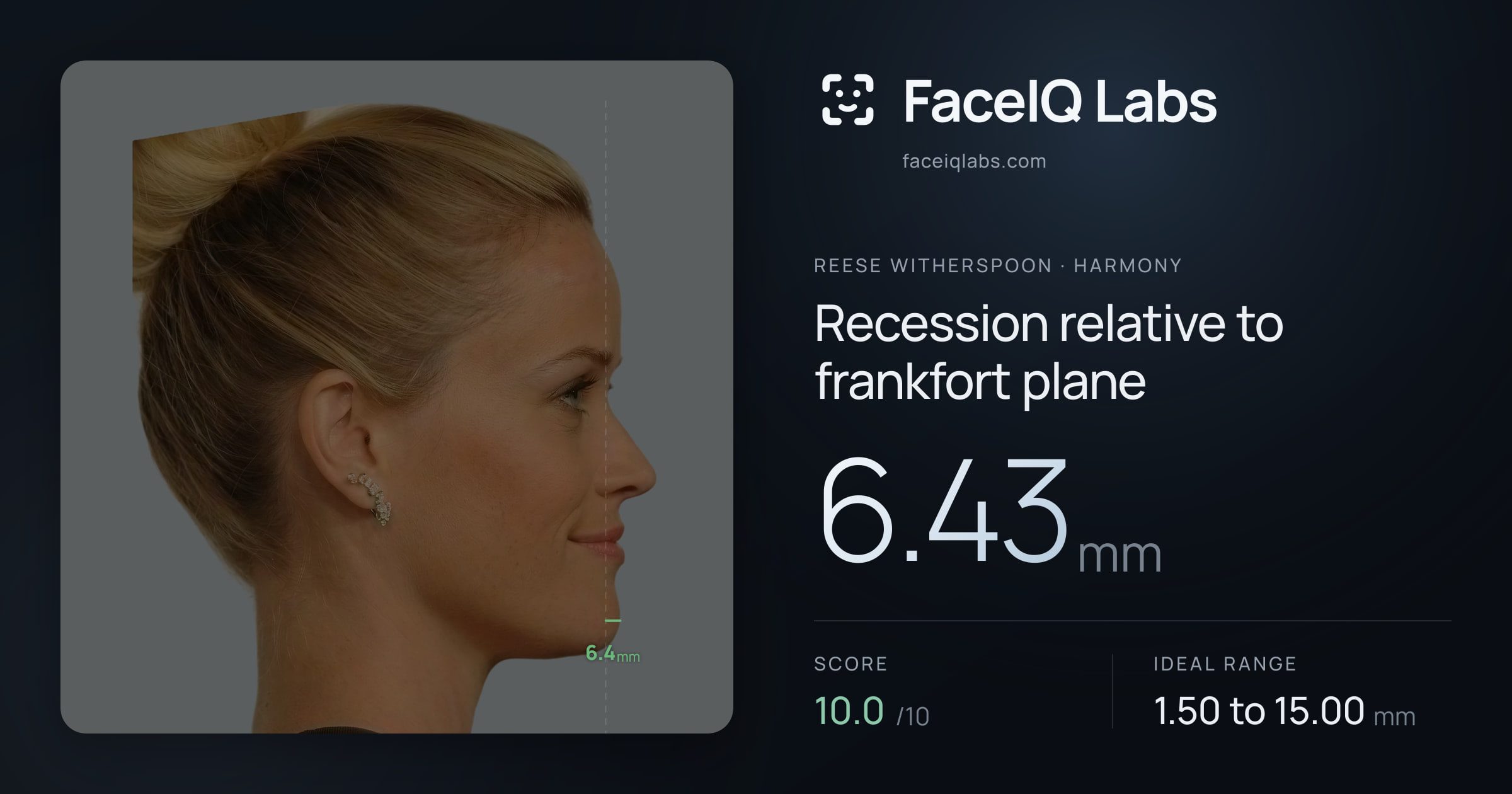 Reese Witherspoon Recession relative to frankfort plane: 6.43mm, drawn on the photo