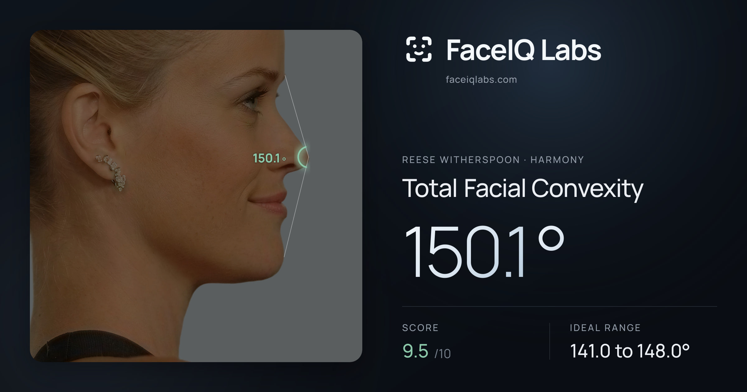 Reese Witherspoon Total Facial Convexity: 150.1°, drawn on the photo