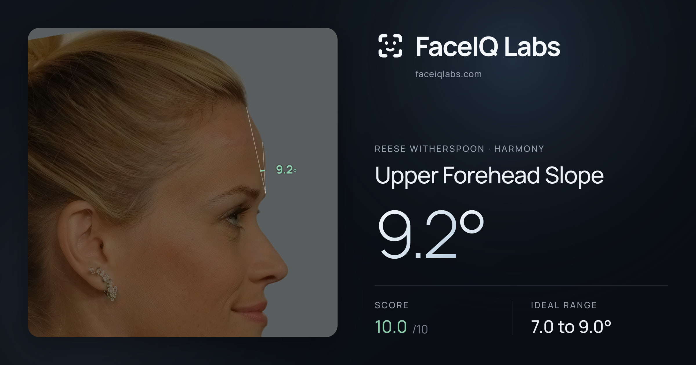 Reese Witherspoon Upper Forehead Slope: 9.2°, drawn on the photo
