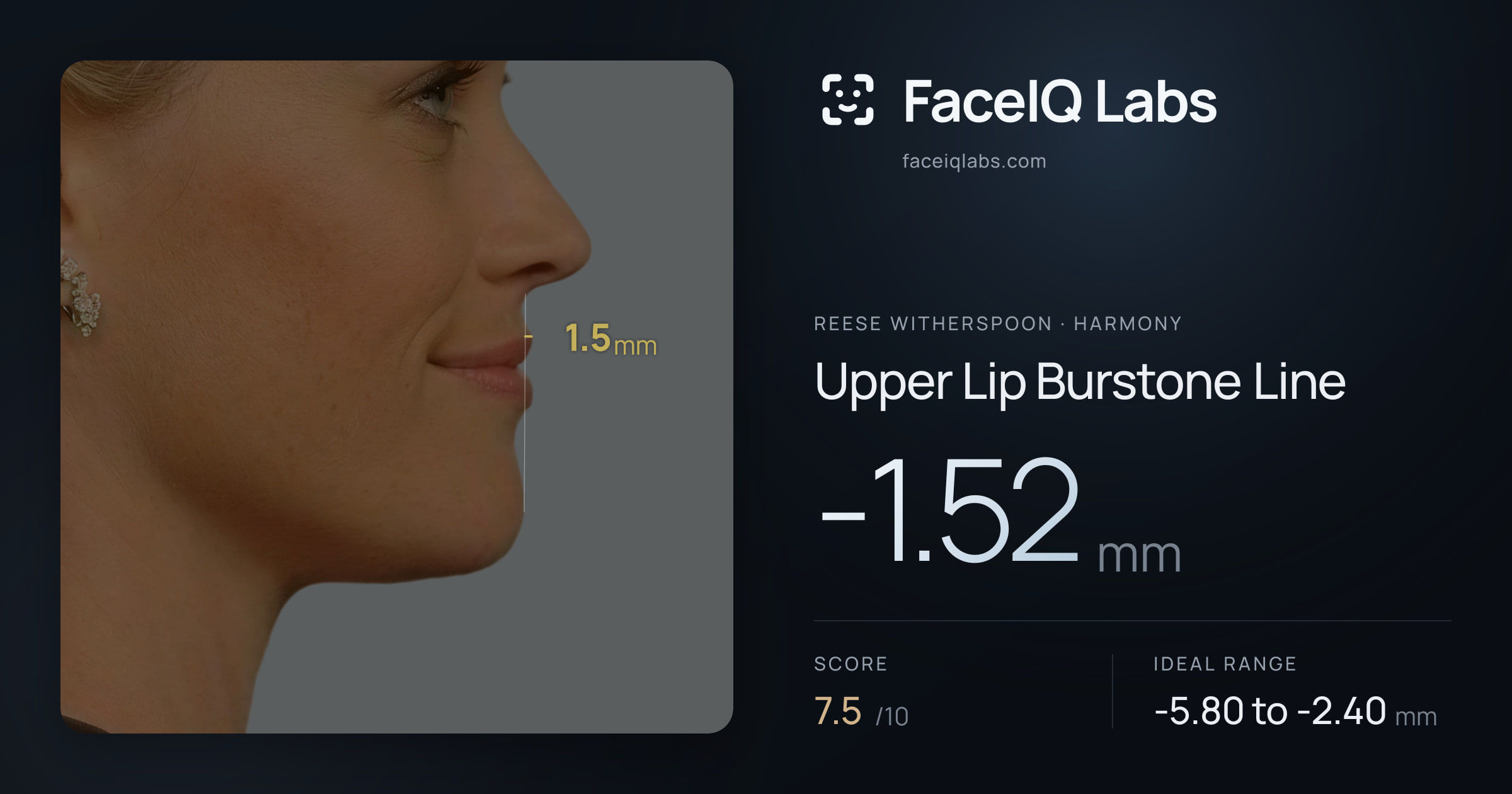 Reese Witherspoon Upper Lip Burstone Line: -1.52mm, drawn on the photo
