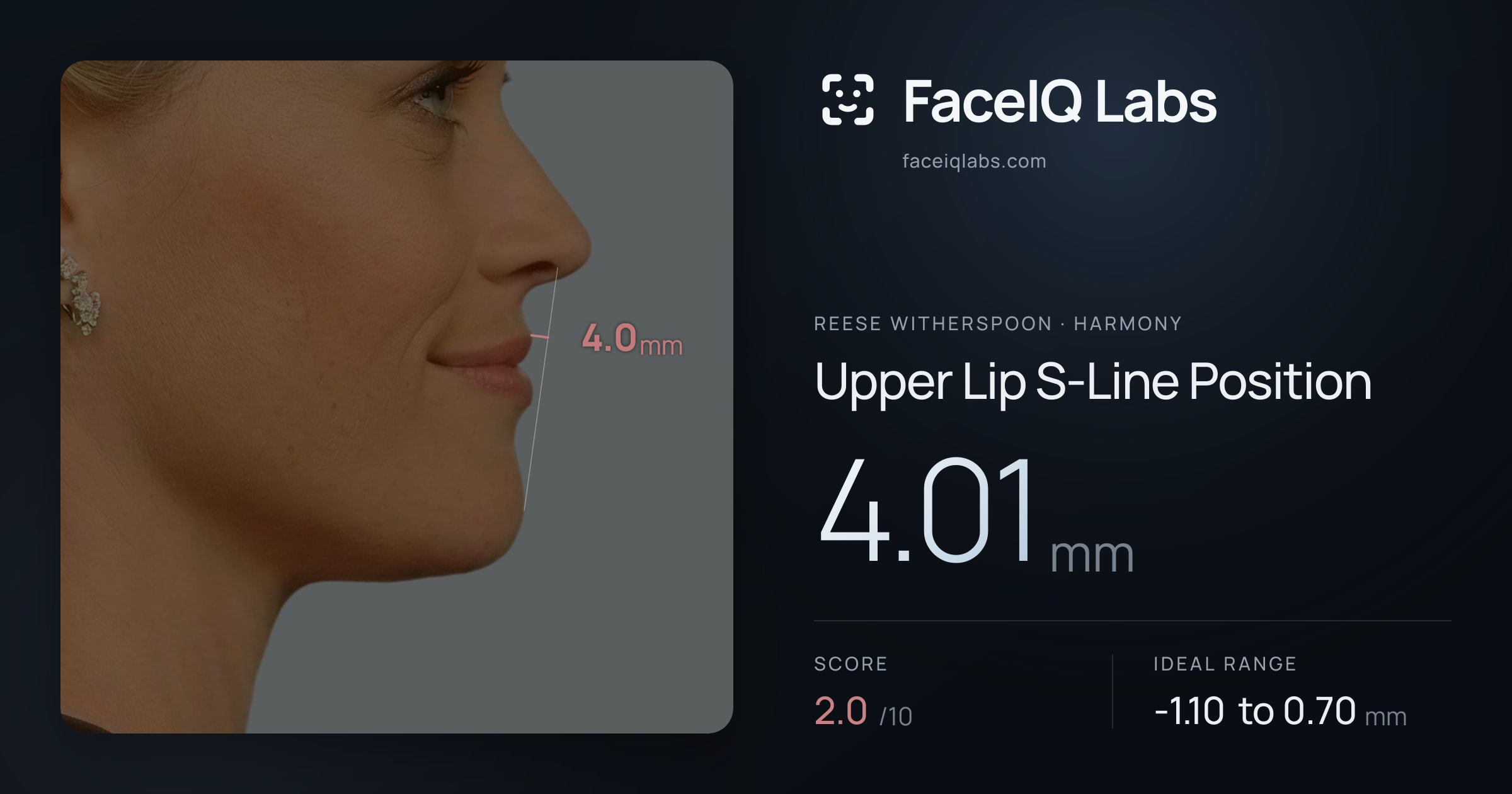 Reese Witherspoon Upper Lip S-Line Position: 4.01mm, drawn on the photo