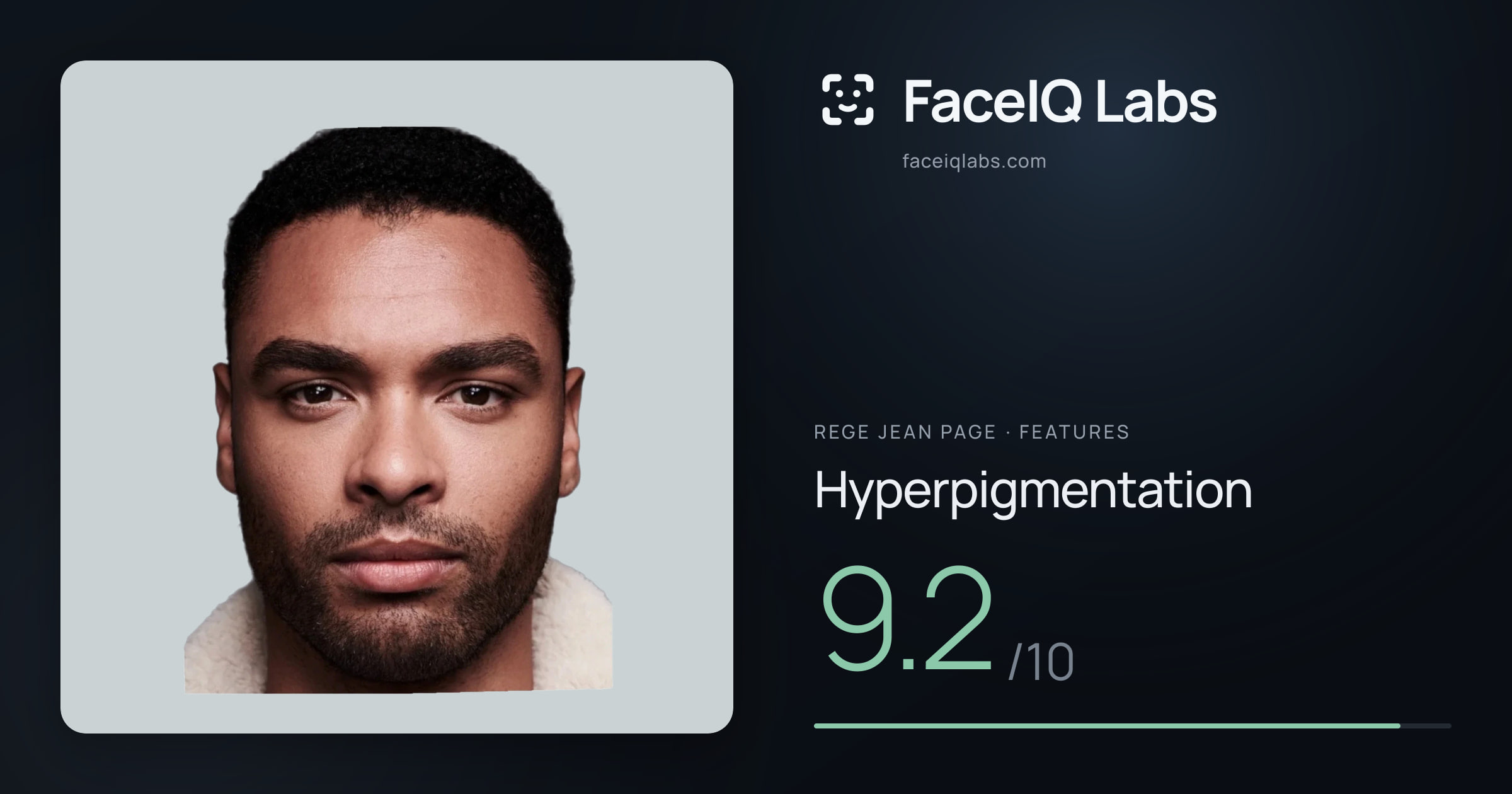 Rege Jean Page Hyperpigmentation: 9.2/10, drawn on the photo